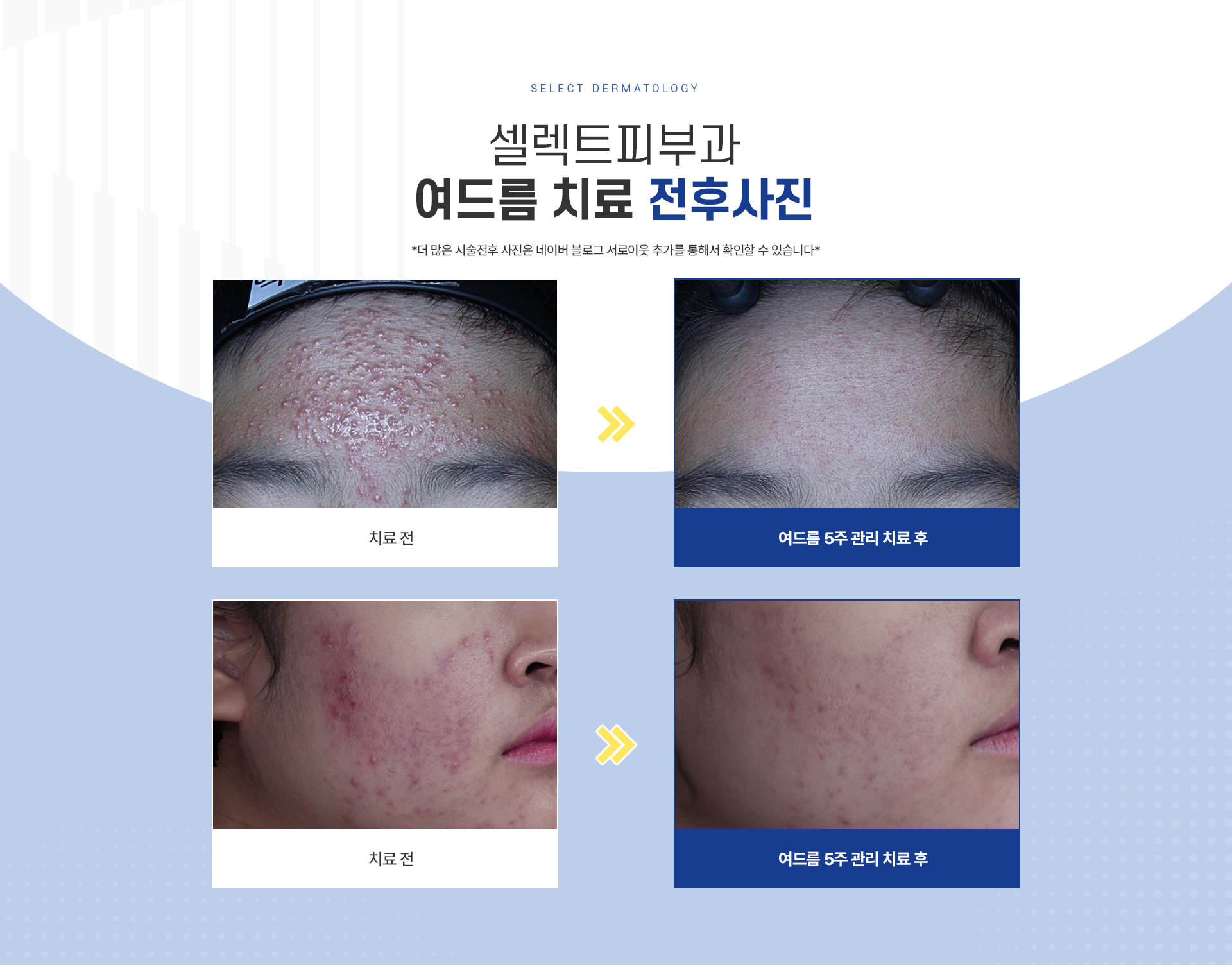 5주/10주 프로그램 종류