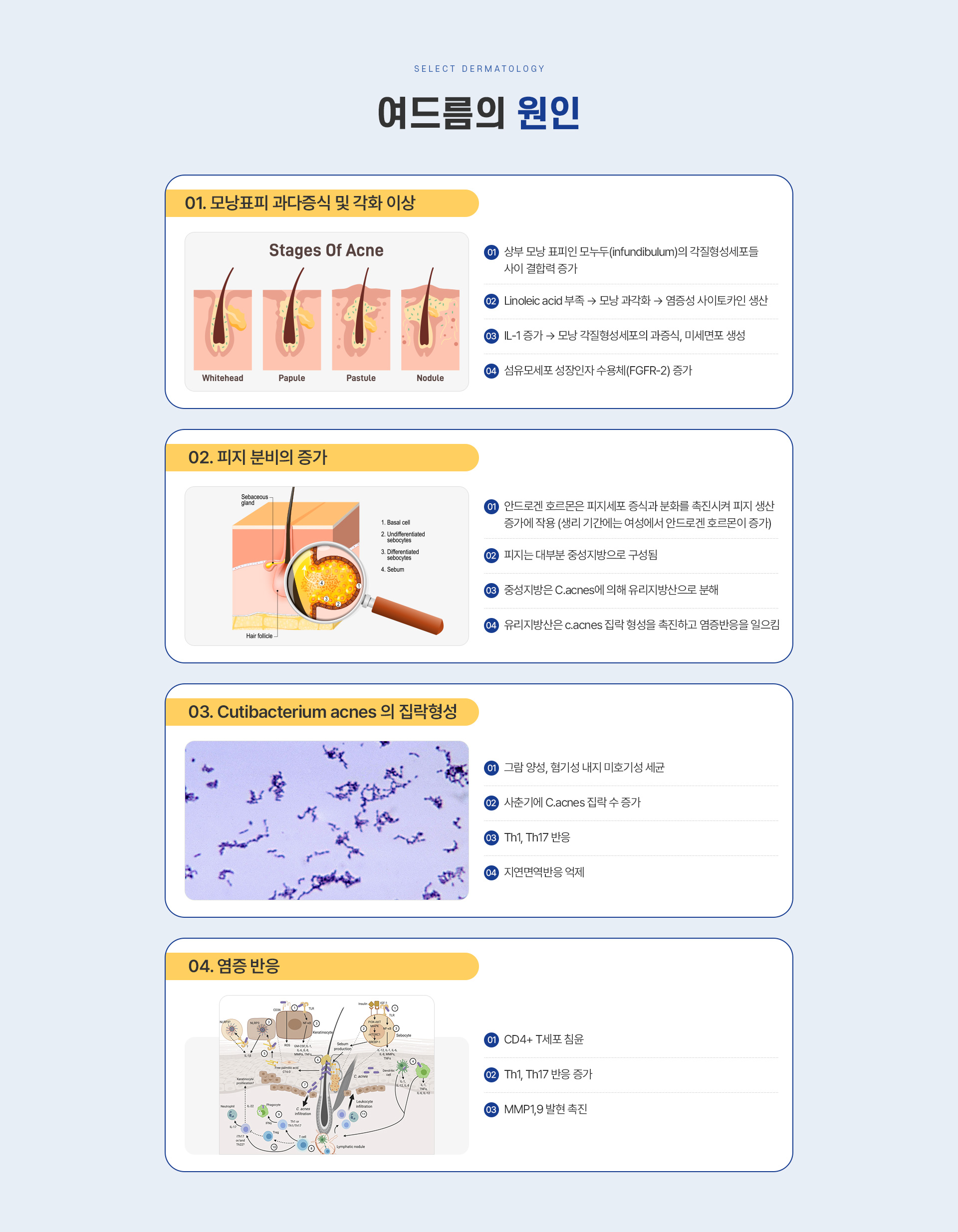 짜지않는여드름관리 종류