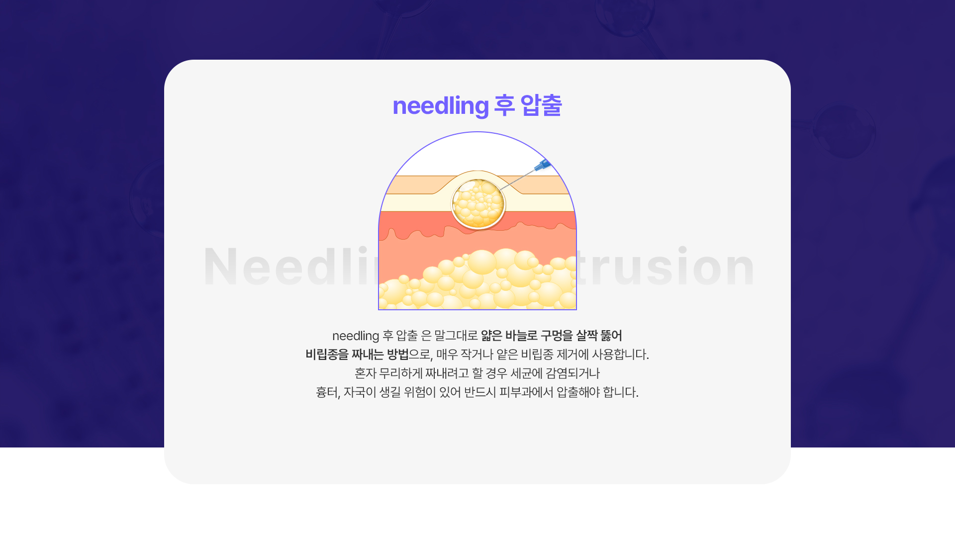 니들링후압출 1번내용