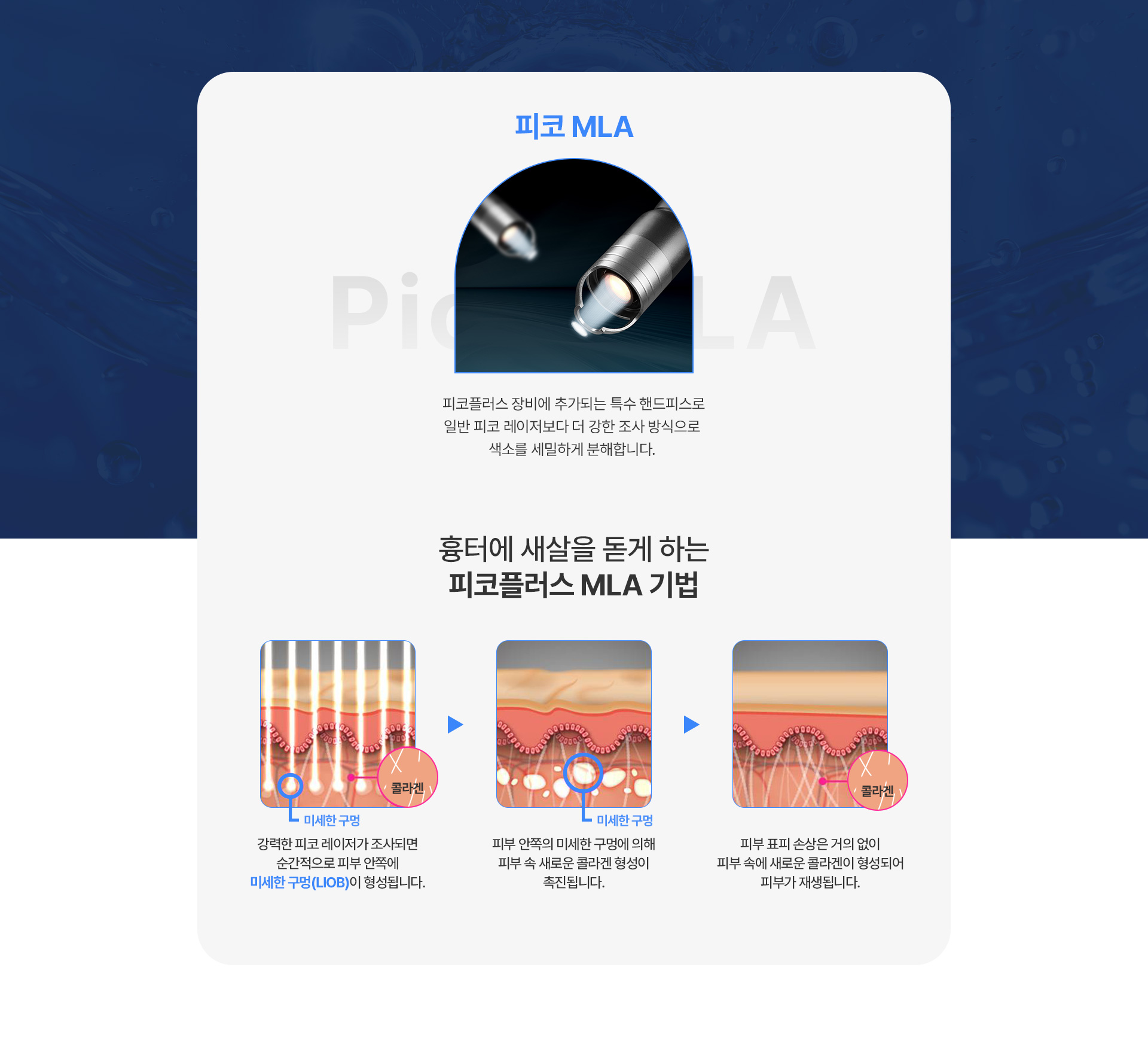 피코MLA 1번내용