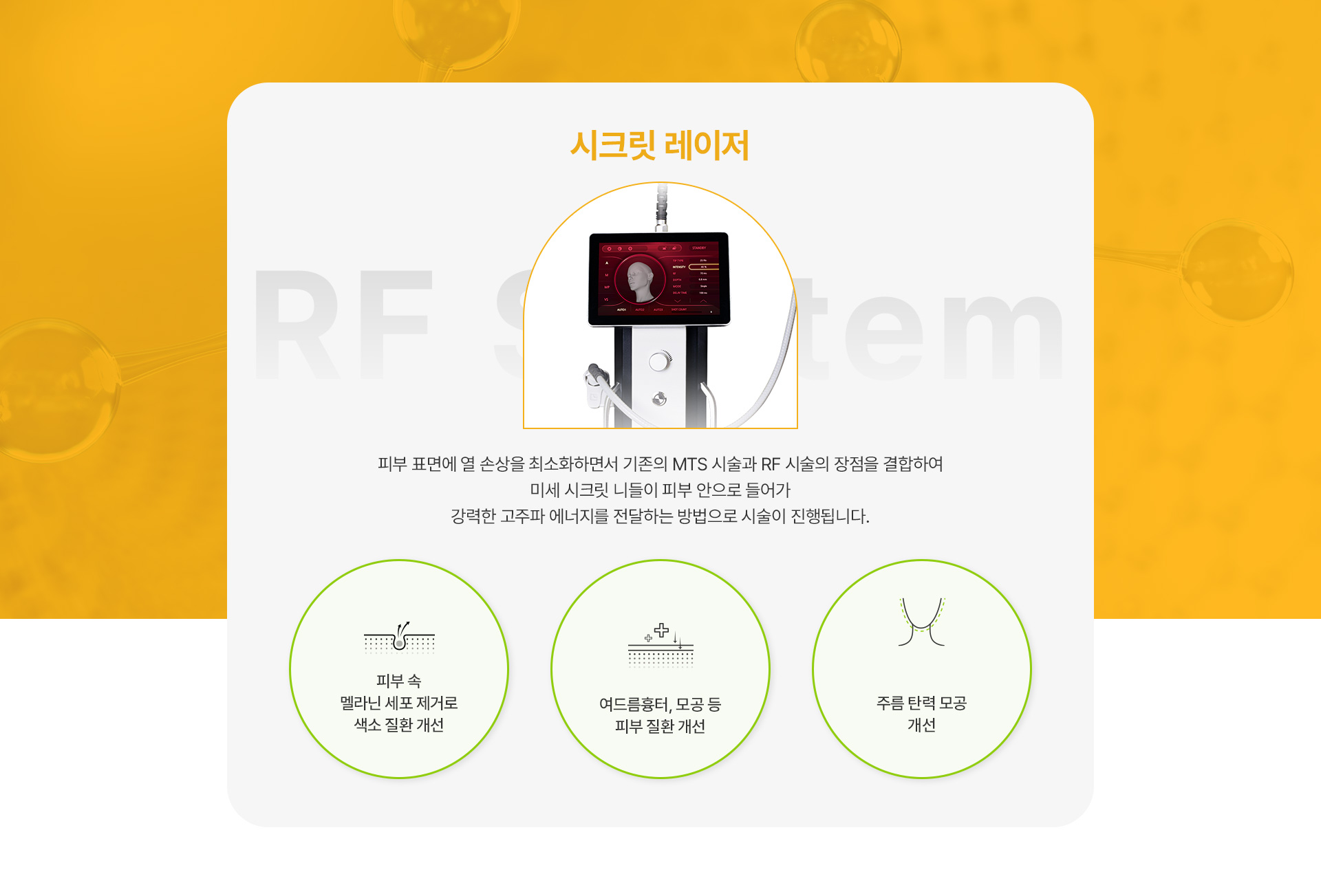 시크릿레이저 단독번내용