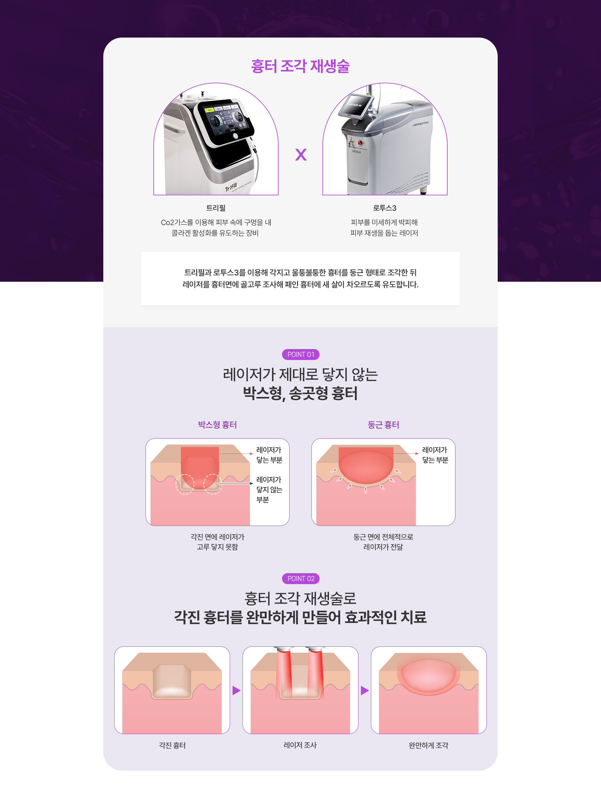 흉터조각재생술 1번내용
