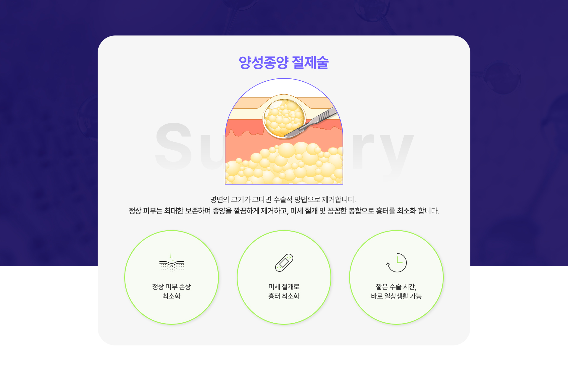 양성종양절제술 1번내용