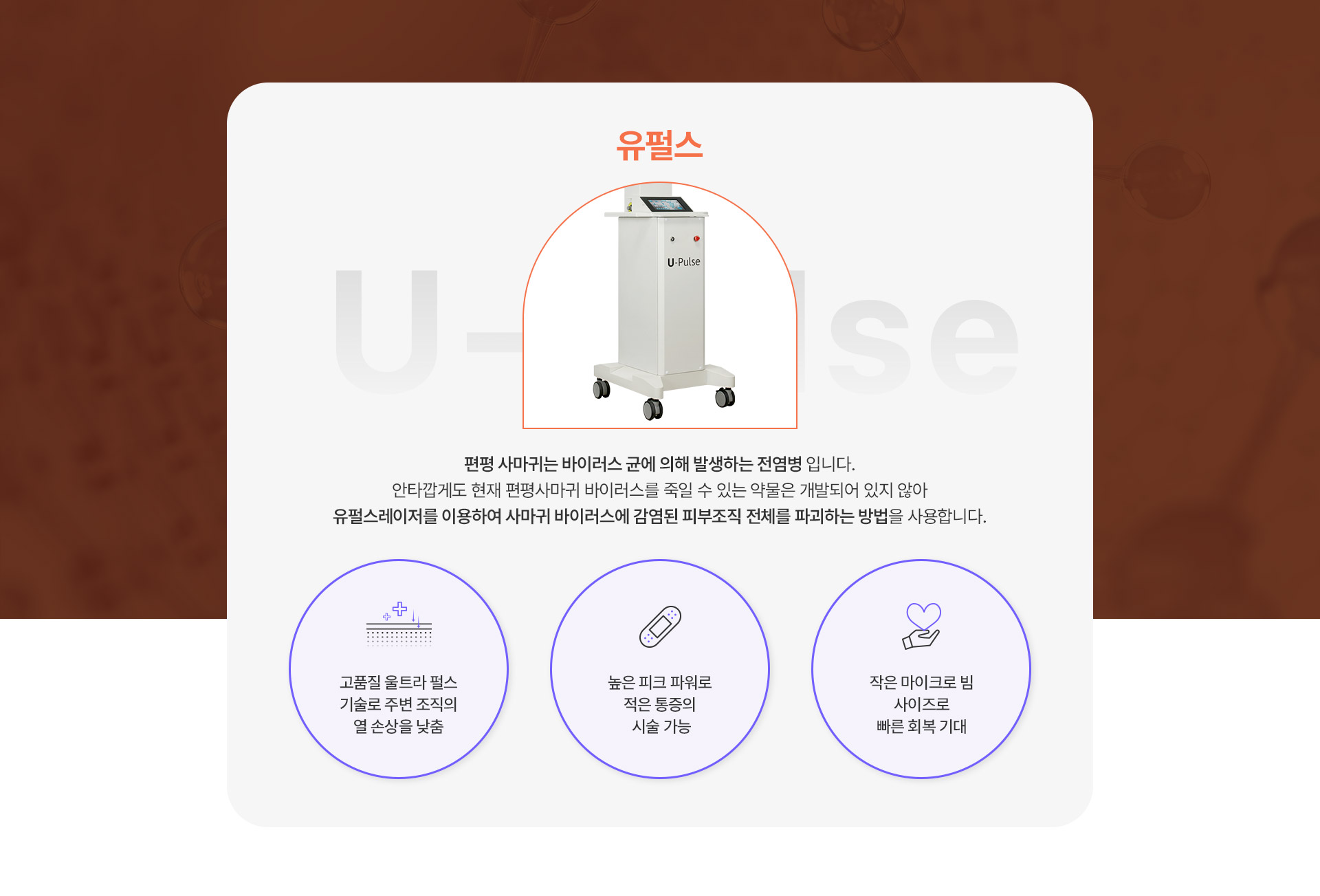 유펄스_편평사마귀 내용