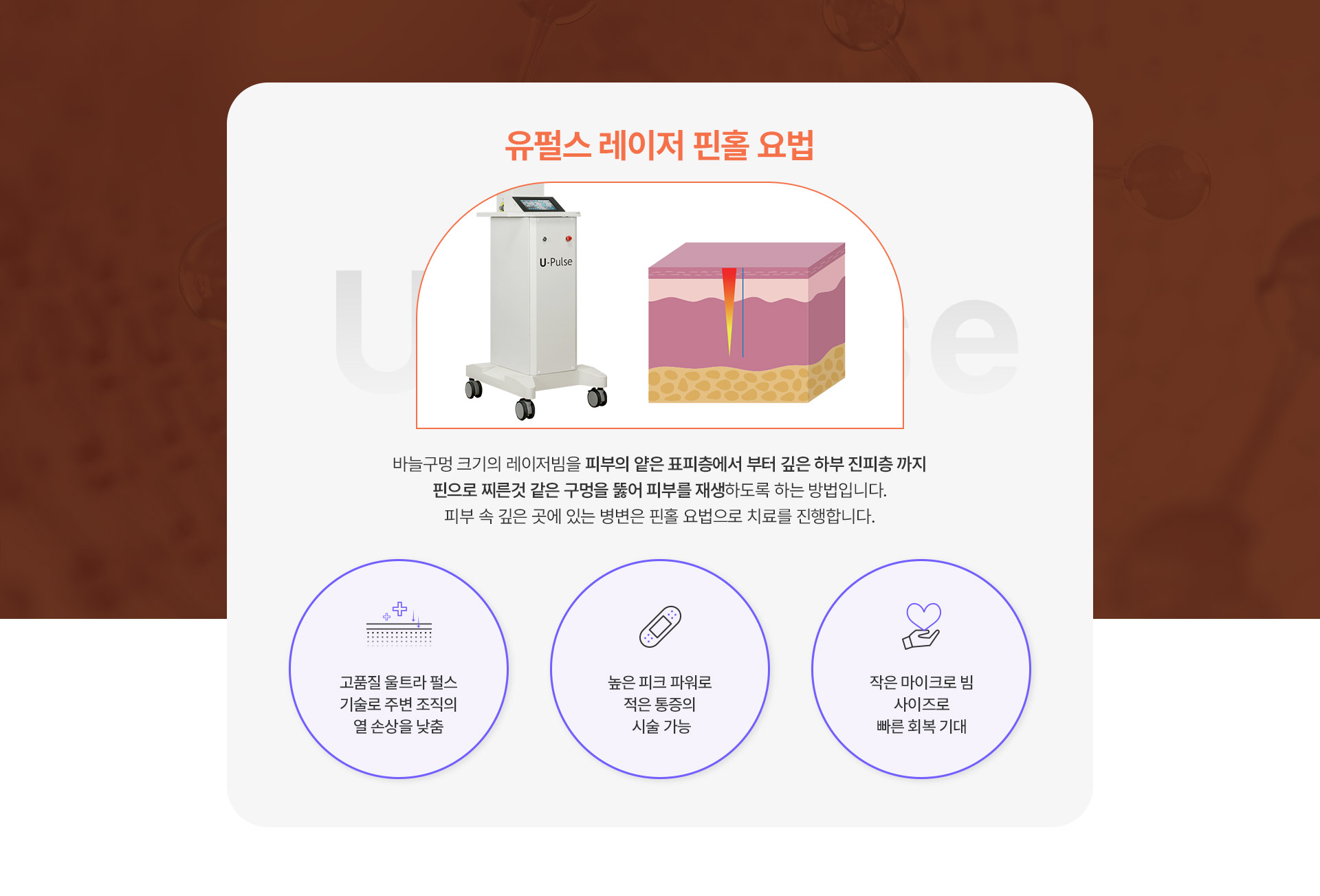 유펄스레이저핀홀 1번내용