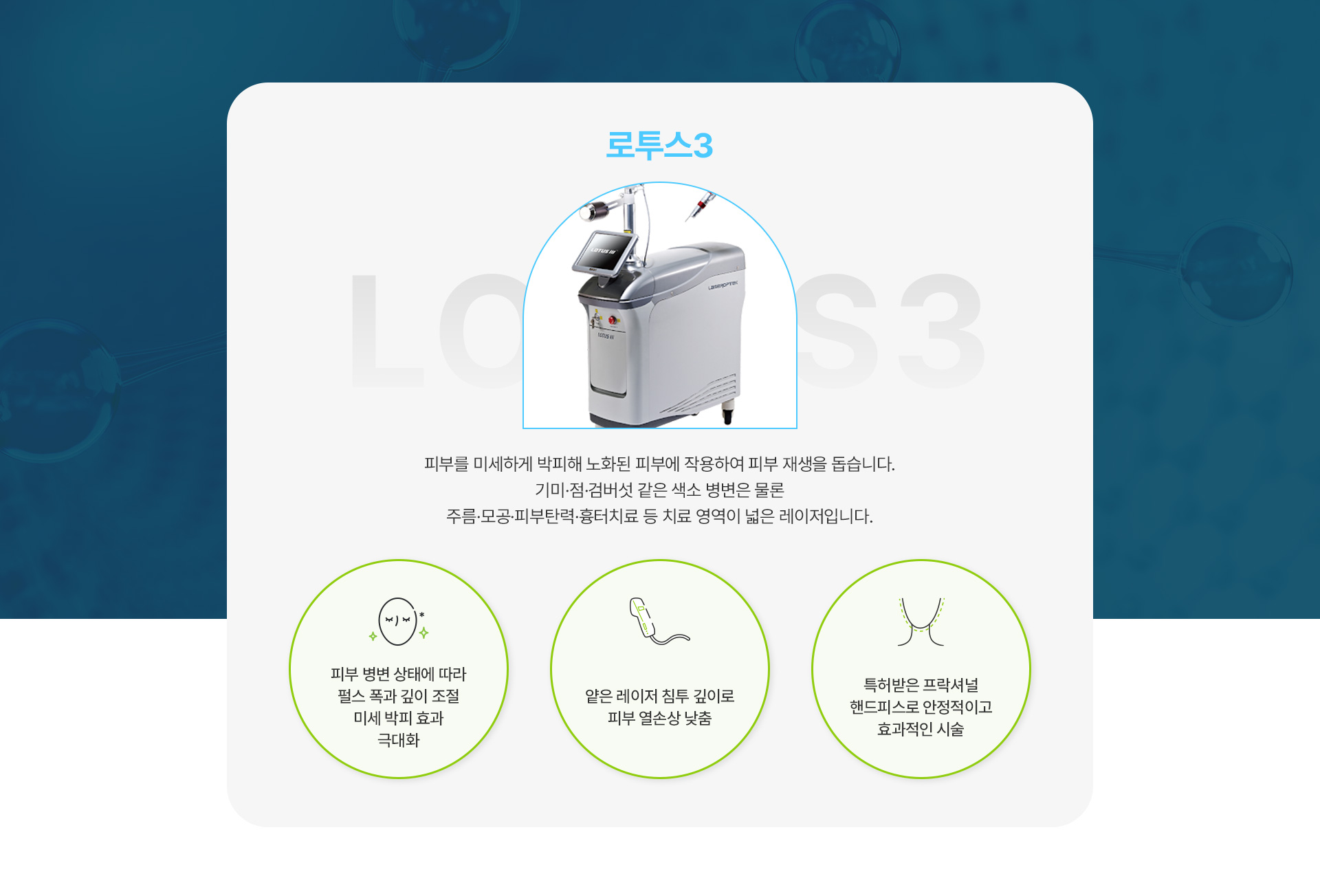 로투스 1번내용