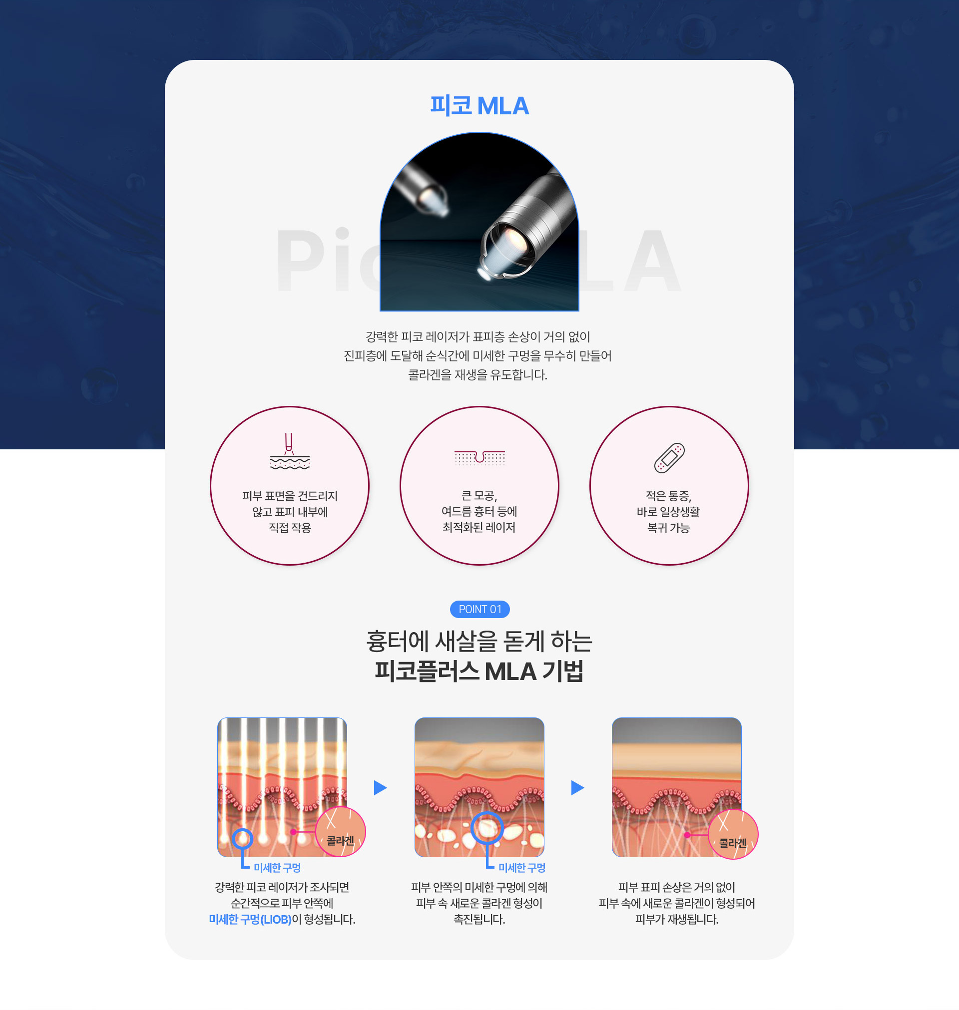피코MLA 1번내용