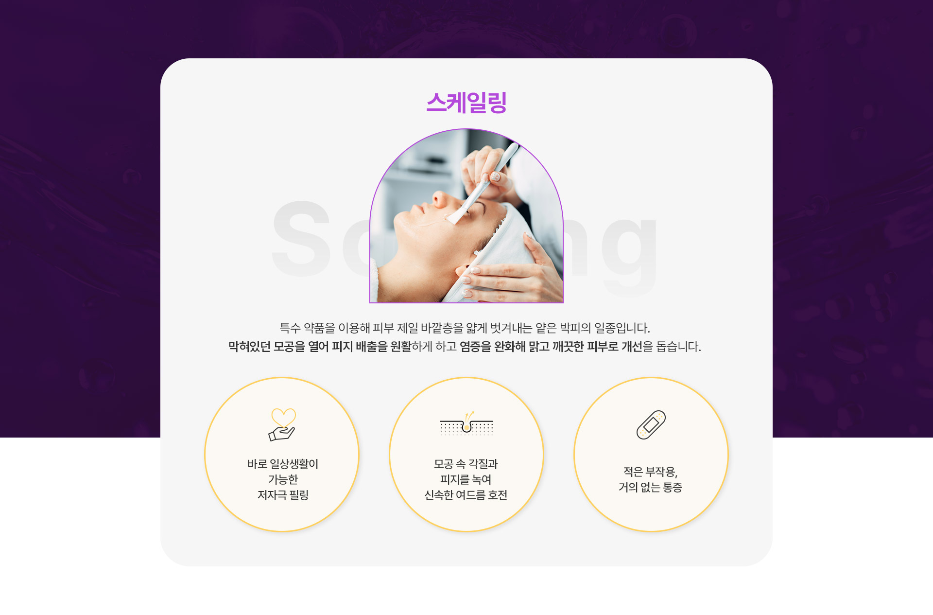 스케일링 1번내용