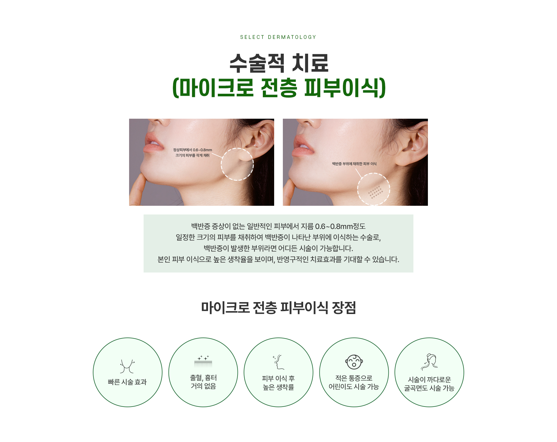 시술적치료 1번내용