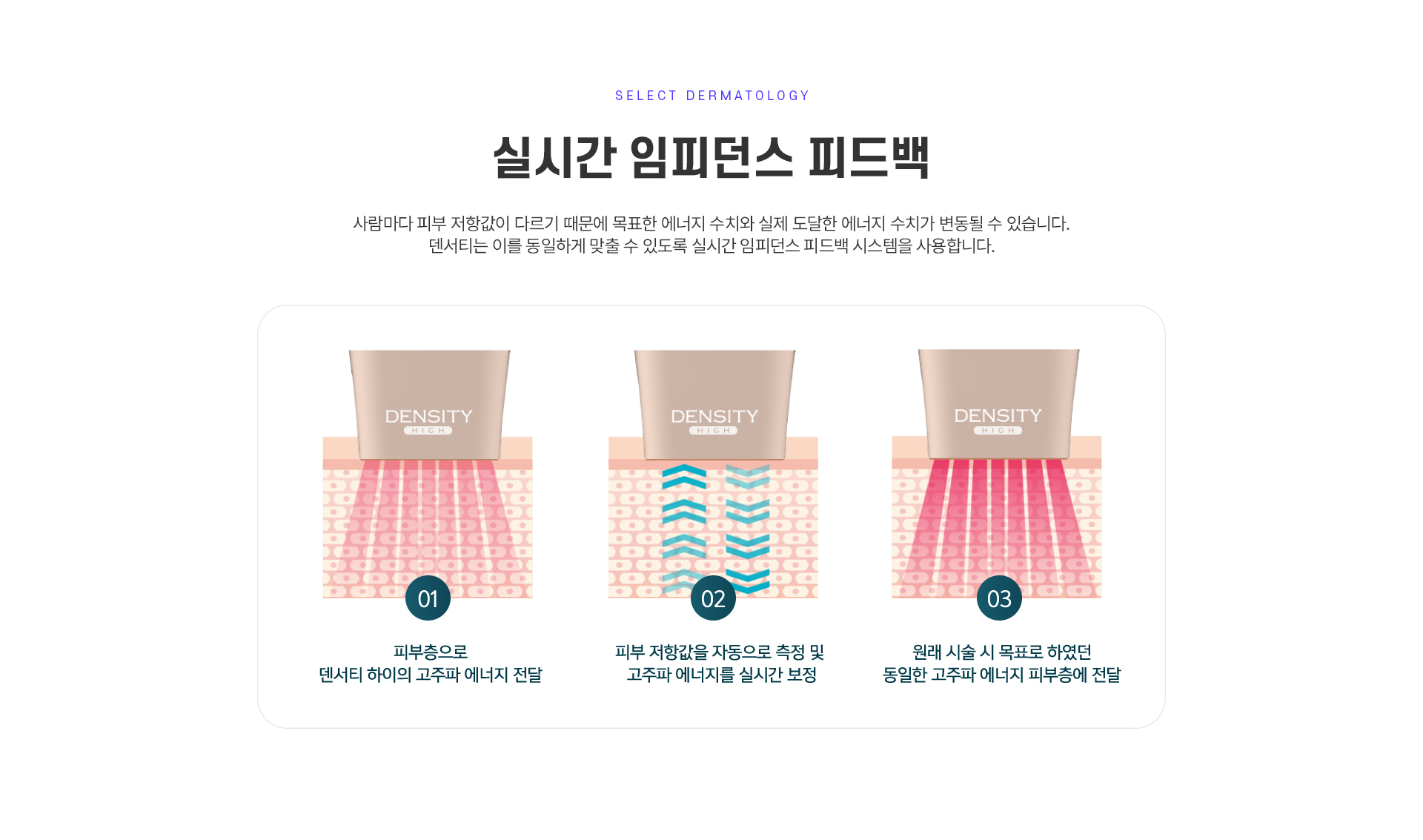 덴서티 치료방법
