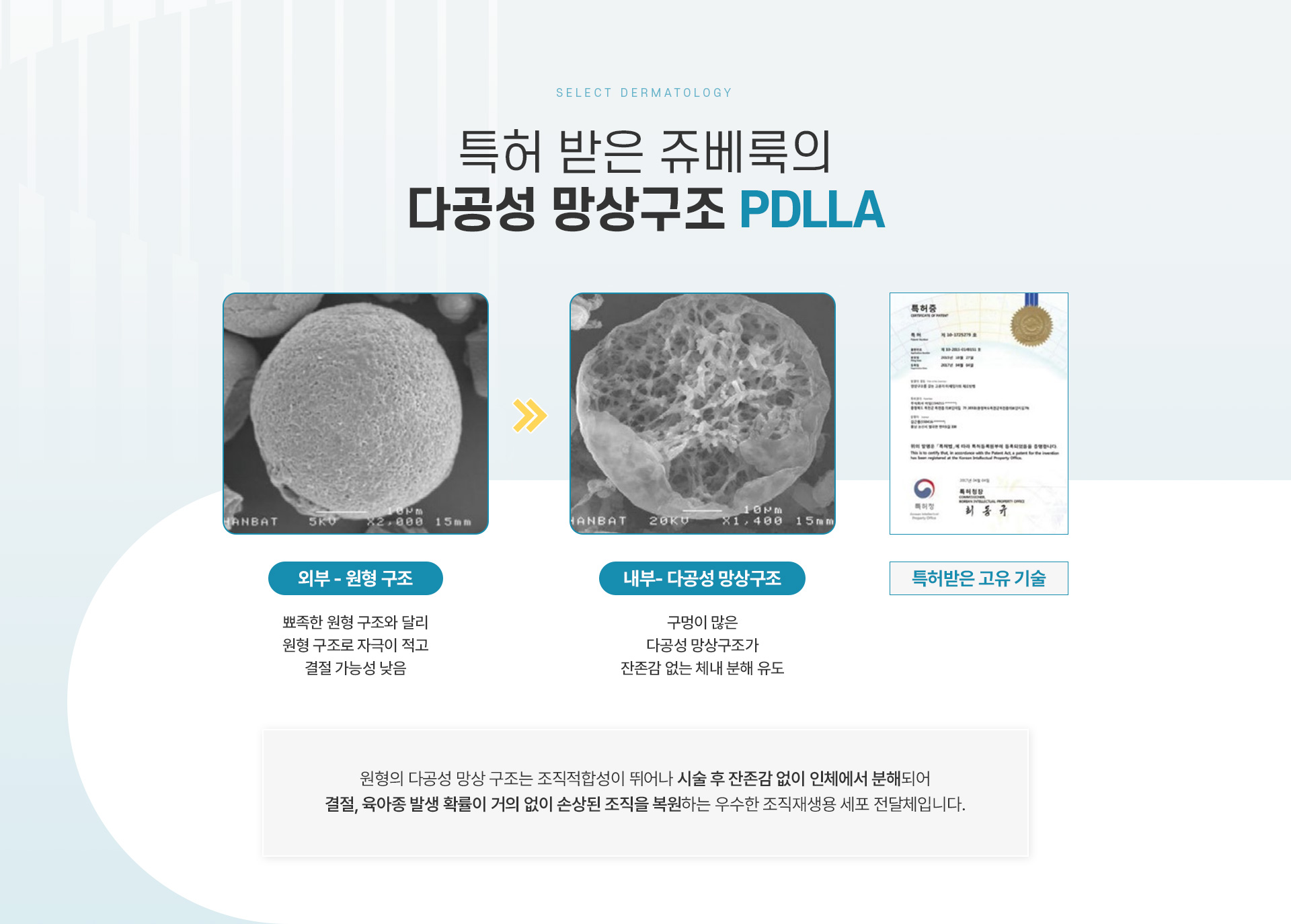 쥬베룩 치료방법