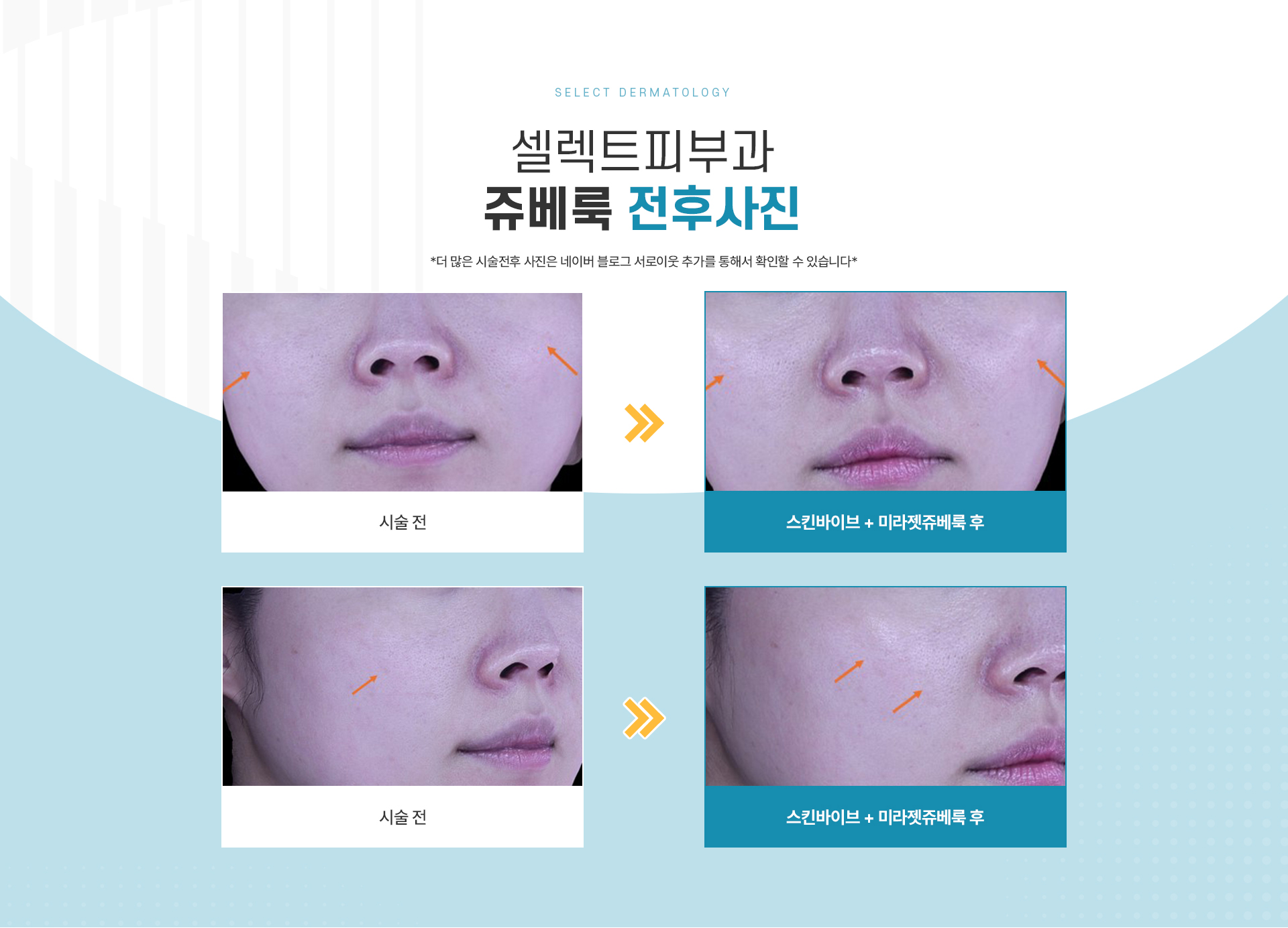 쥬베룩 전후사진