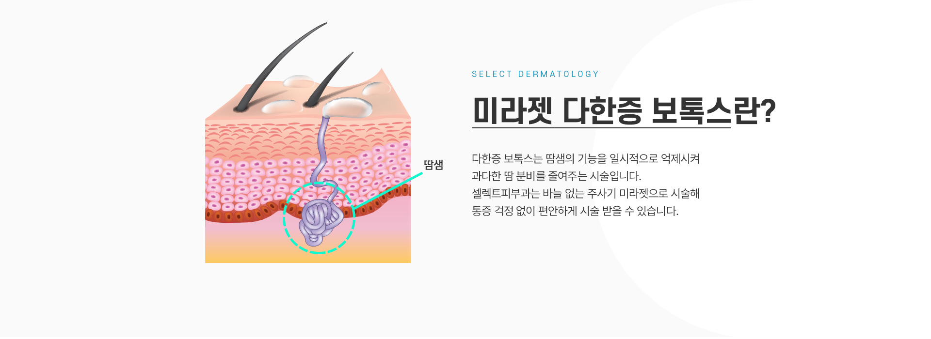 미라젯다한증보톡스 설명