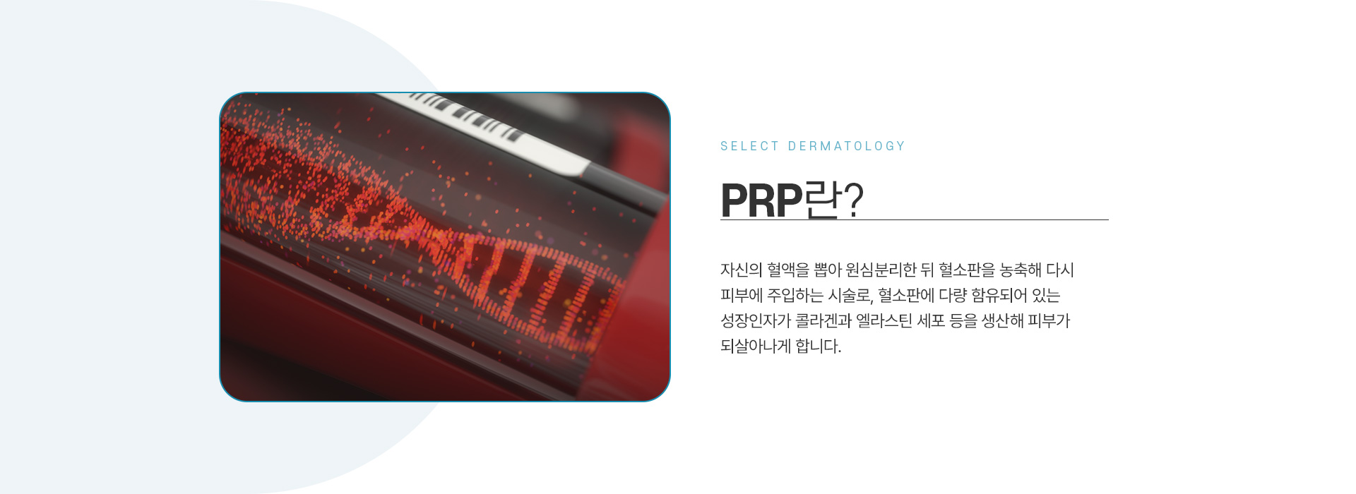 PRP 전후사진