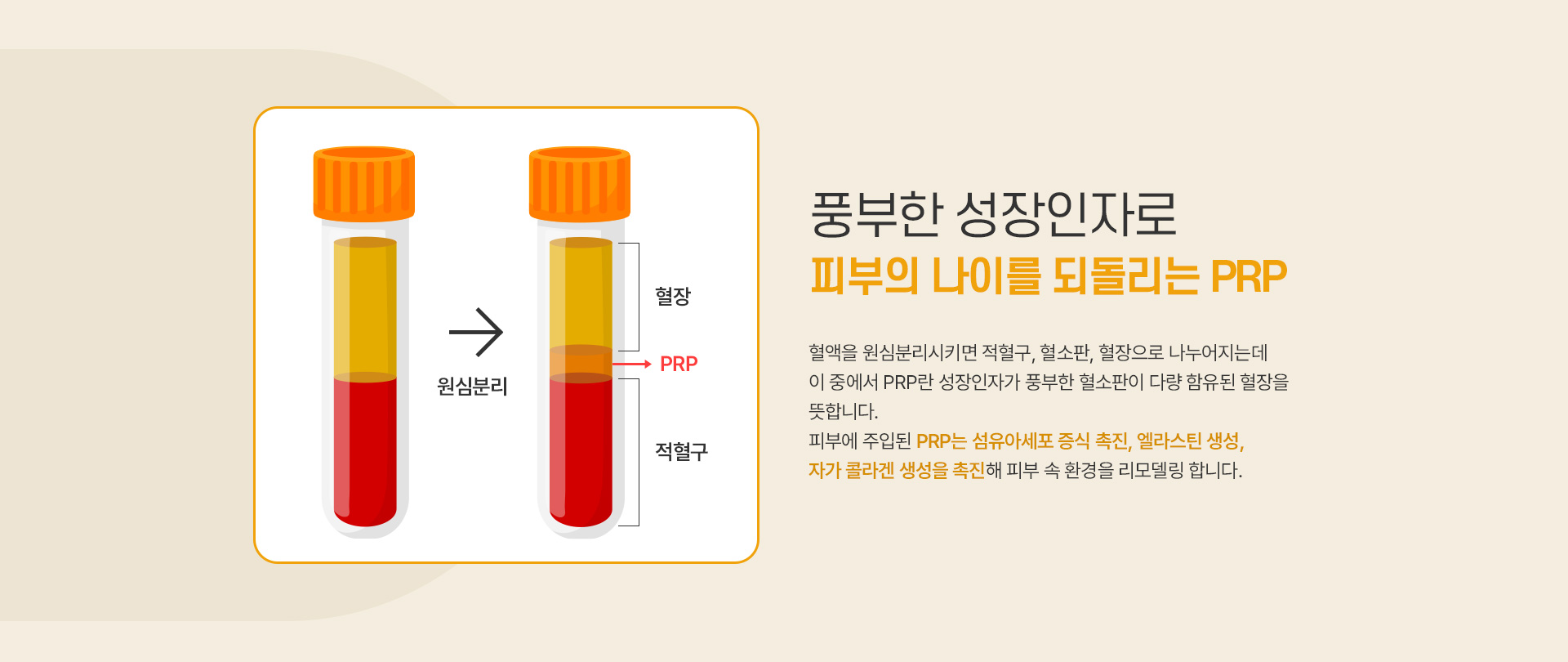 PRP 치료방법