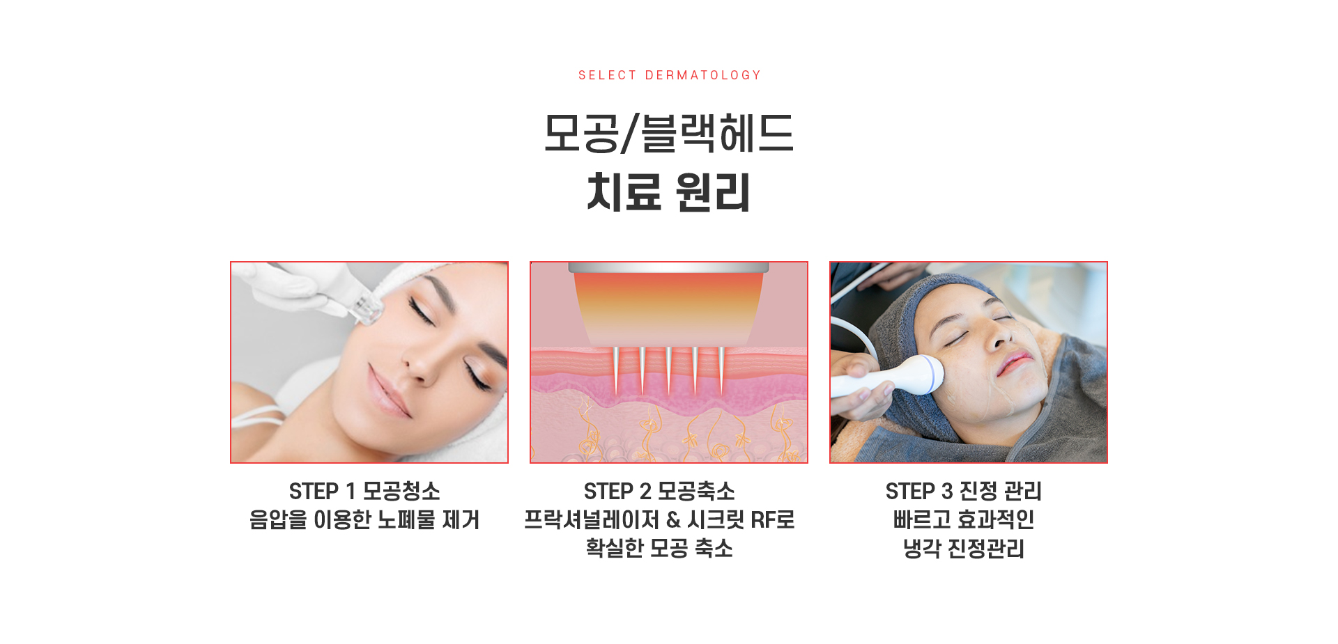 모공블랙헤드 치료방법