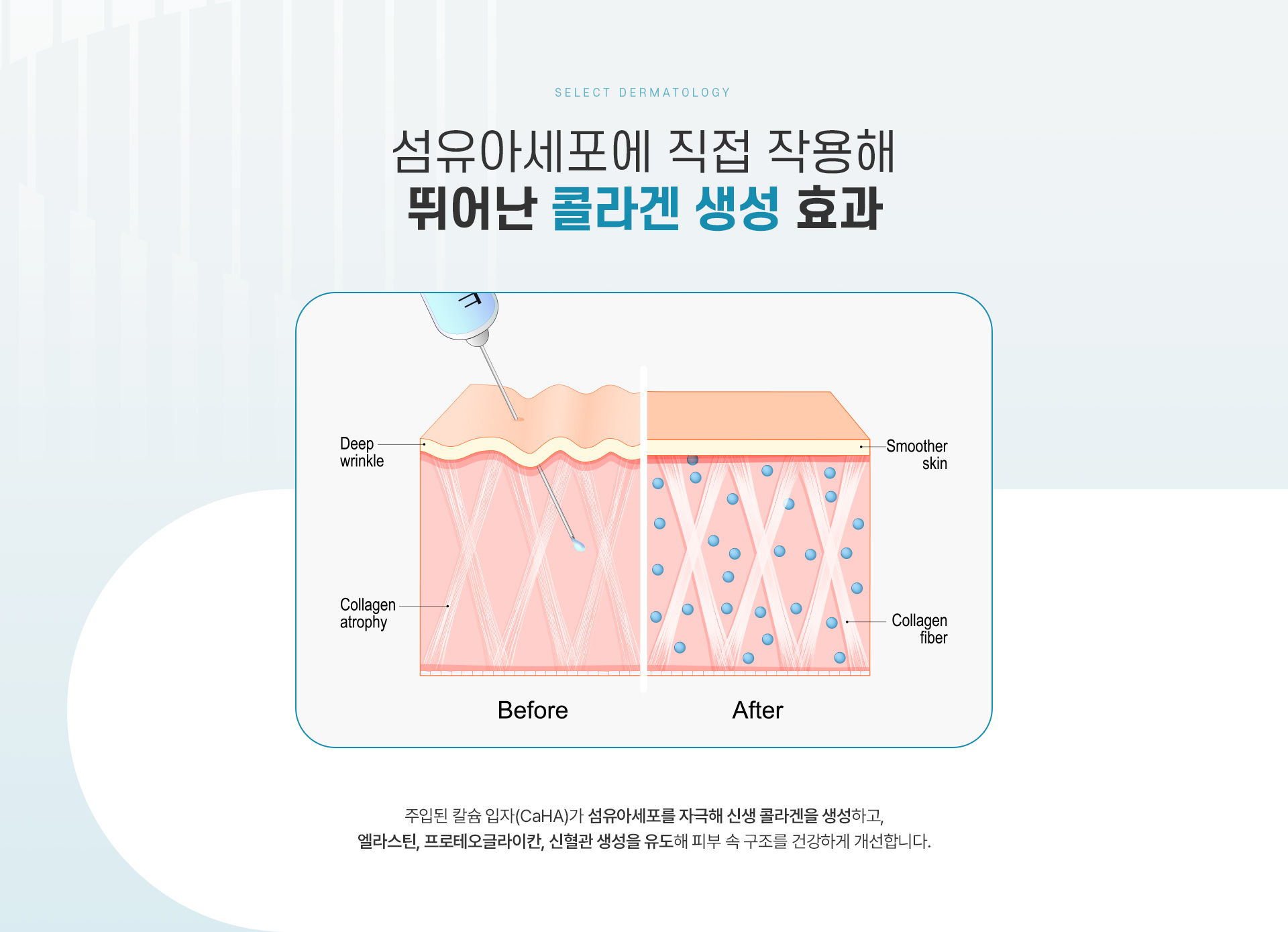 래디어스 설명