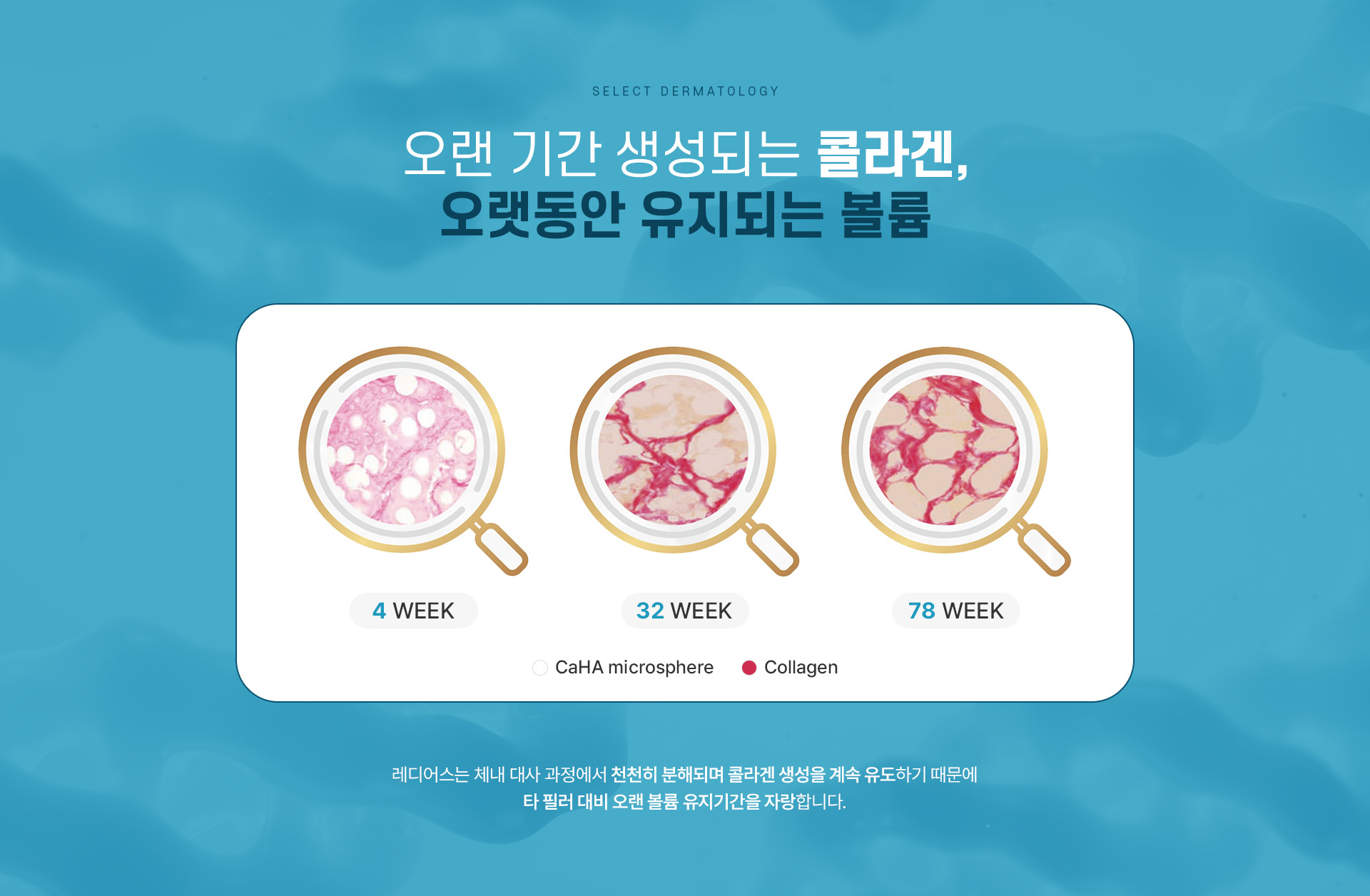 래디어스 치료방법