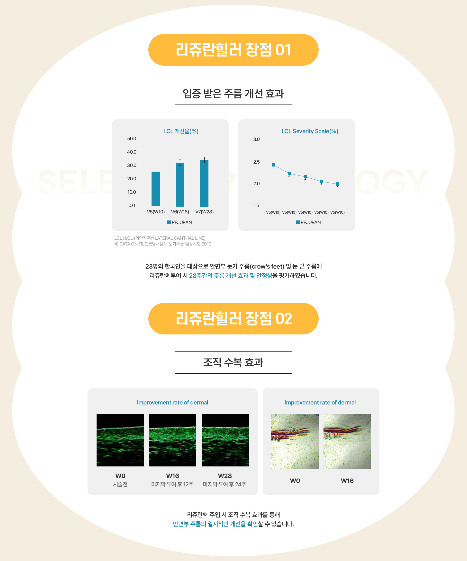 리쥬란 전후사진