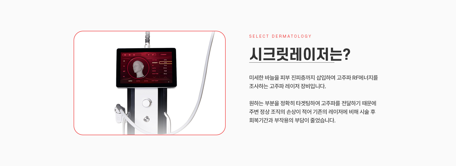 시크릿레이저 전후사진