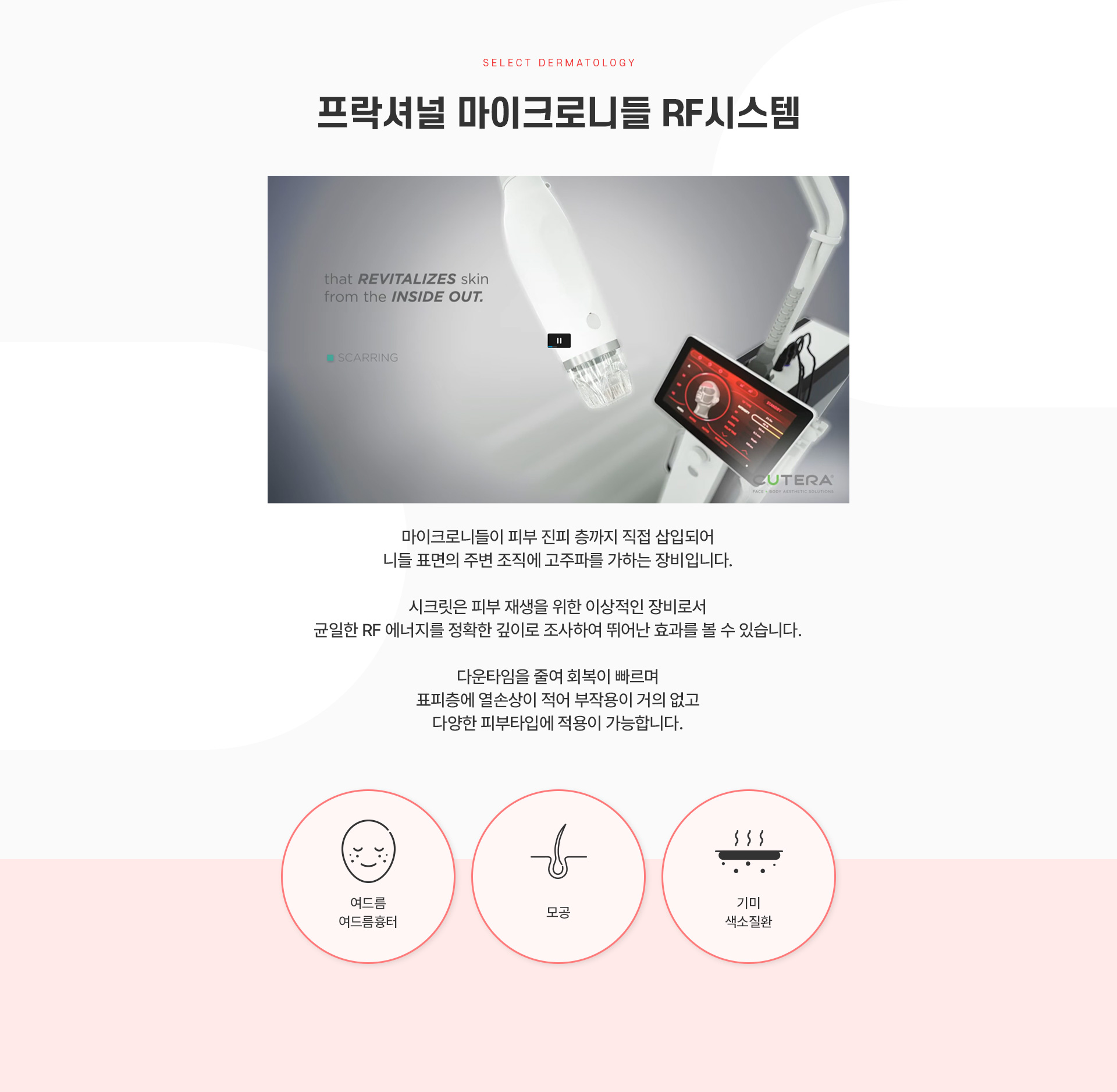 시크릿레이저 치료방법
