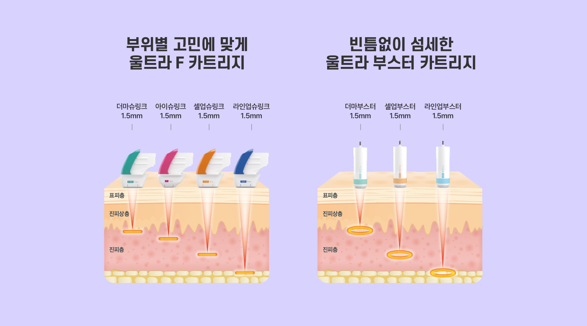 슈링크유니버스 치료방법