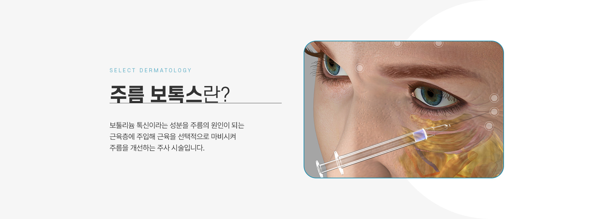 주름보톡스 치료방법