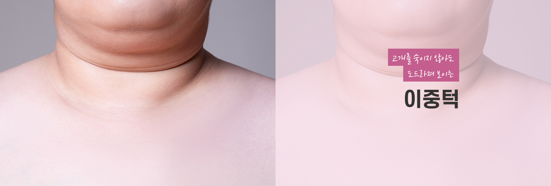 이중턱 키비주얼