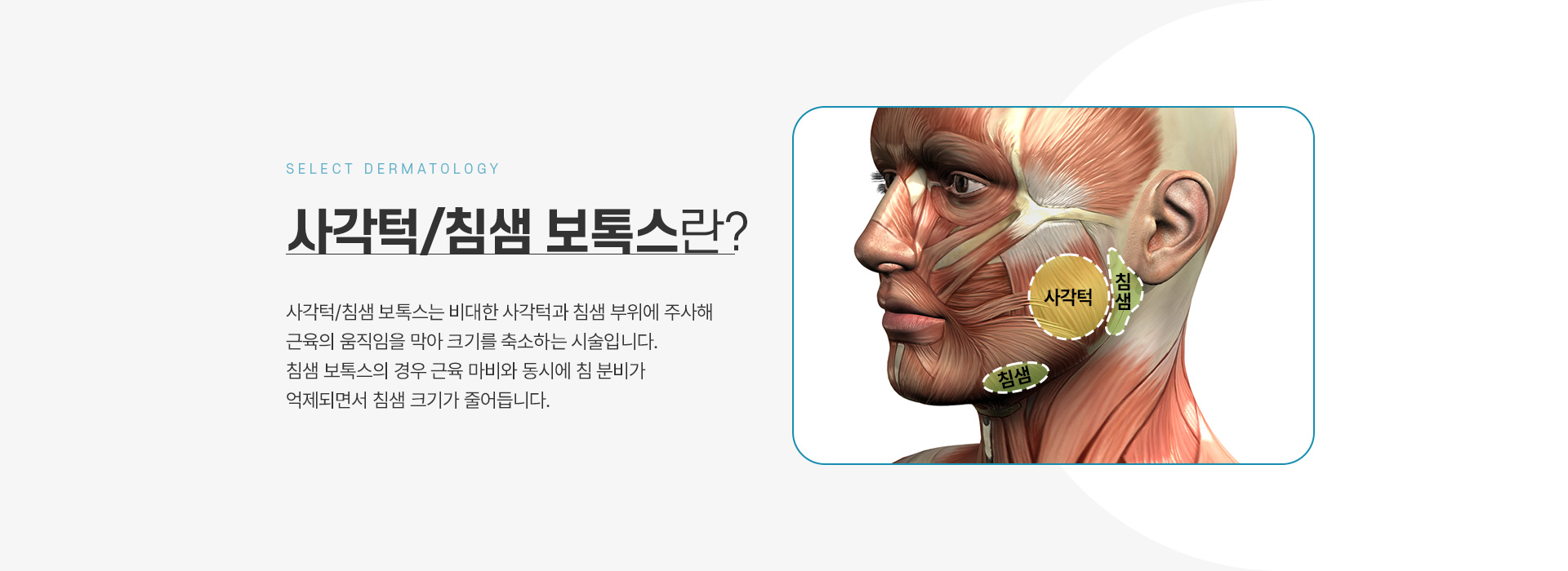 사각턱보톡스 치료방법