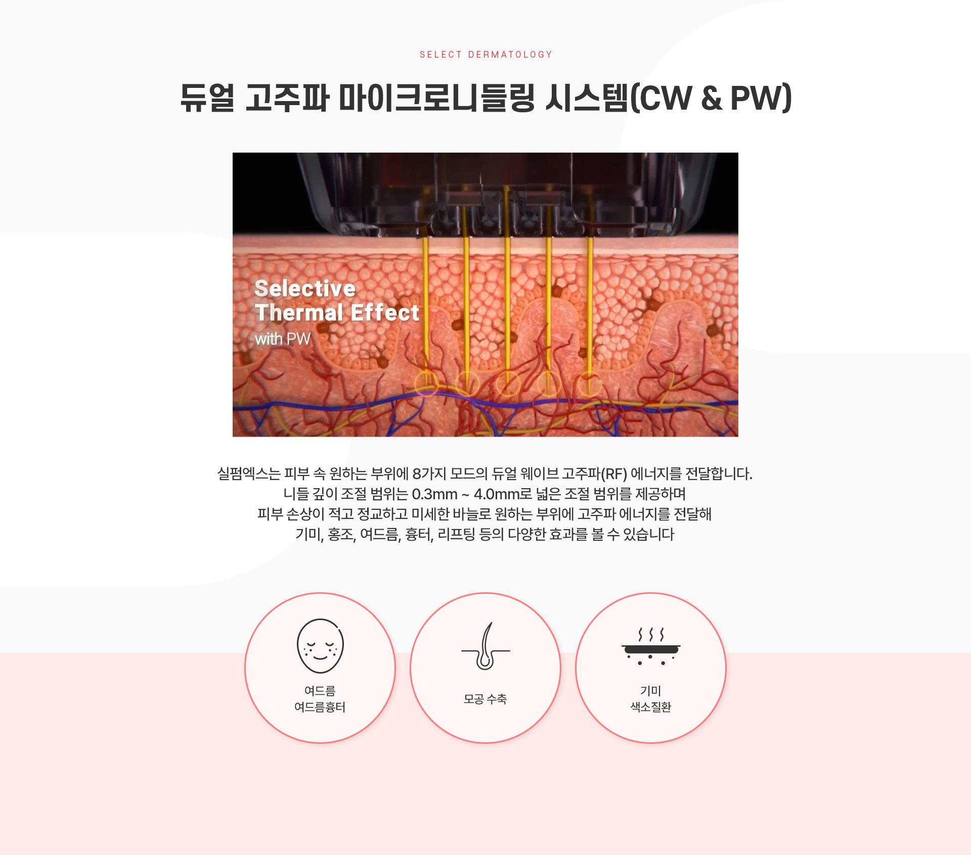 실펌엑스 치료방법