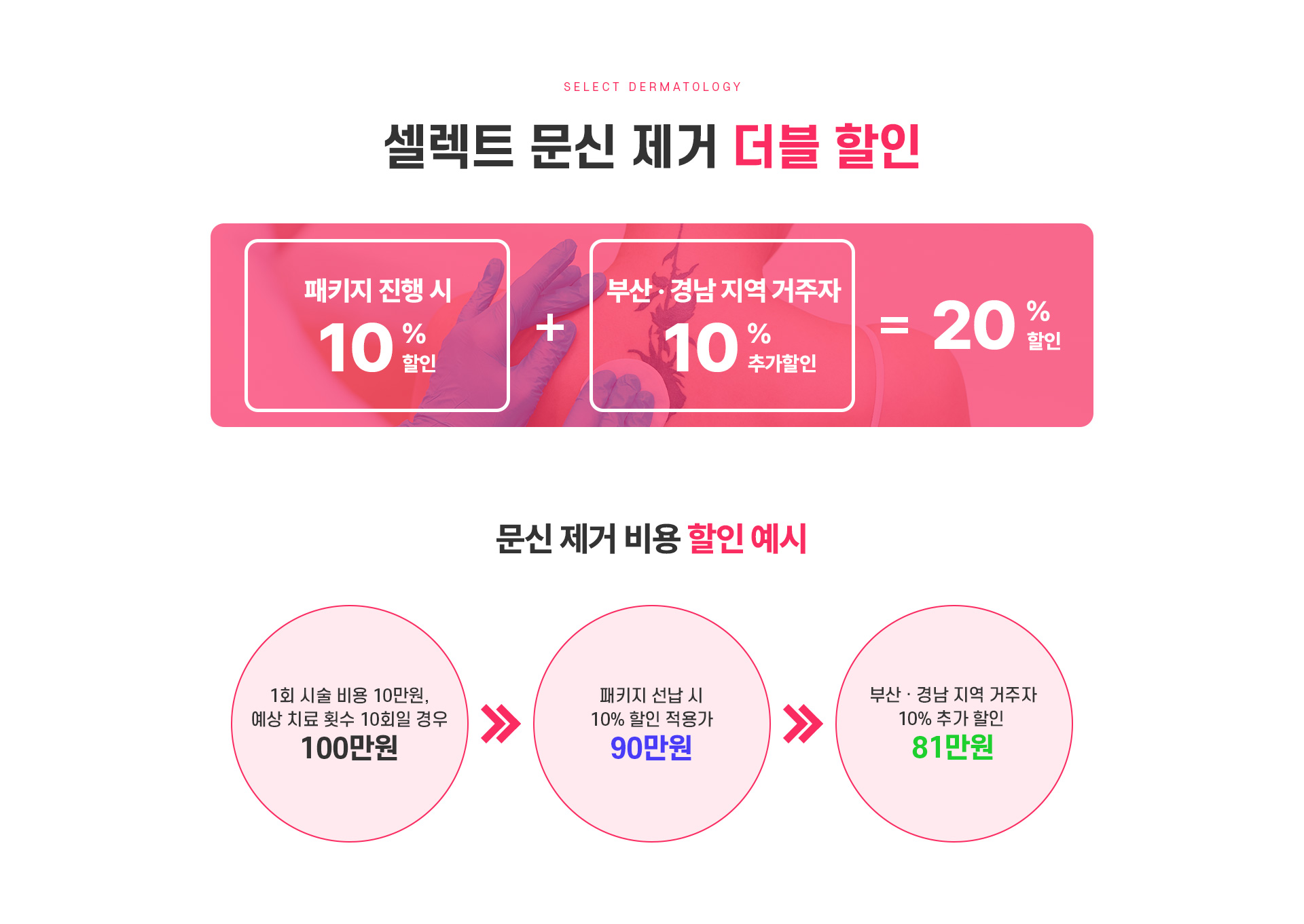 문신제거 치료방법