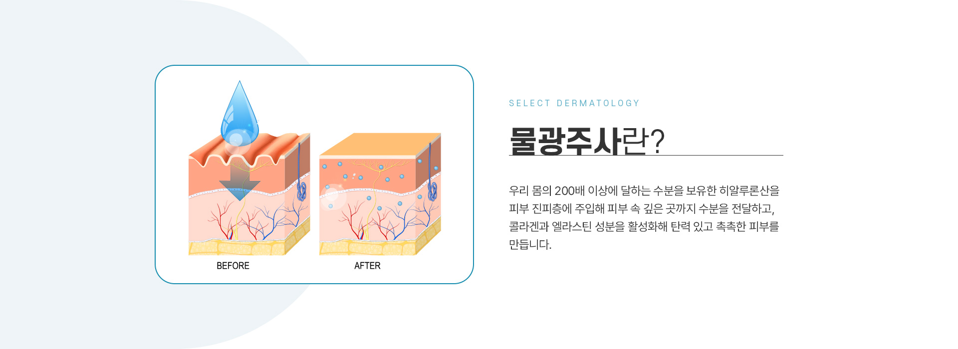 물광주사 전후사진