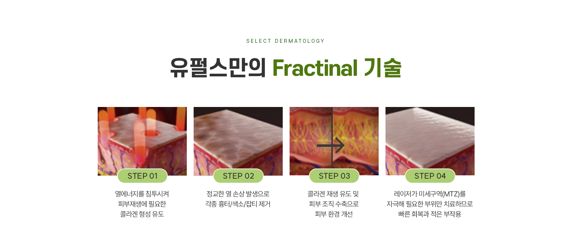 잔주름피부결 치료방법