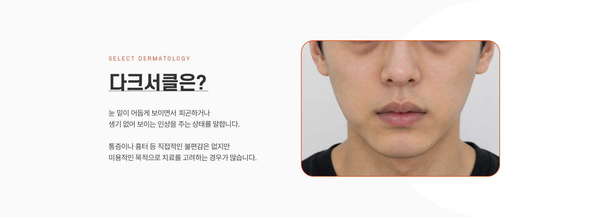 다크서클 소개