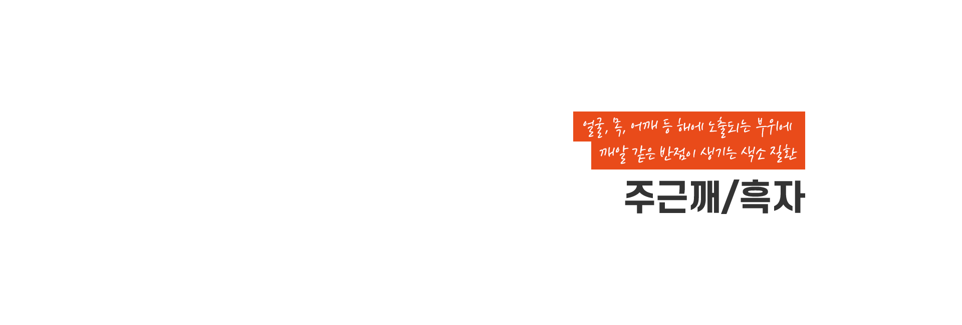 주근깨 키비주얼