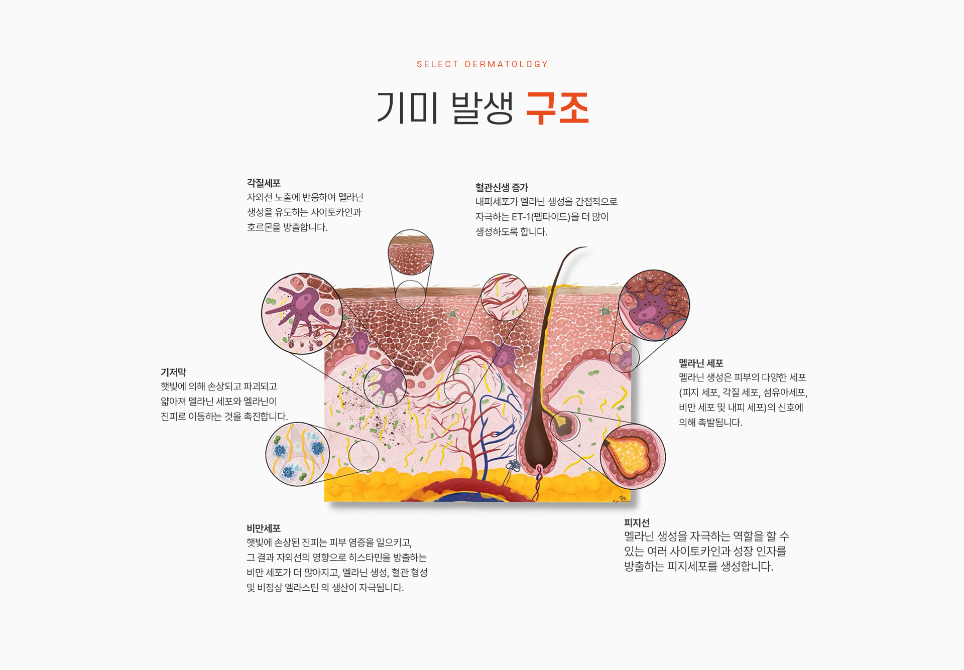 오타모반 종류