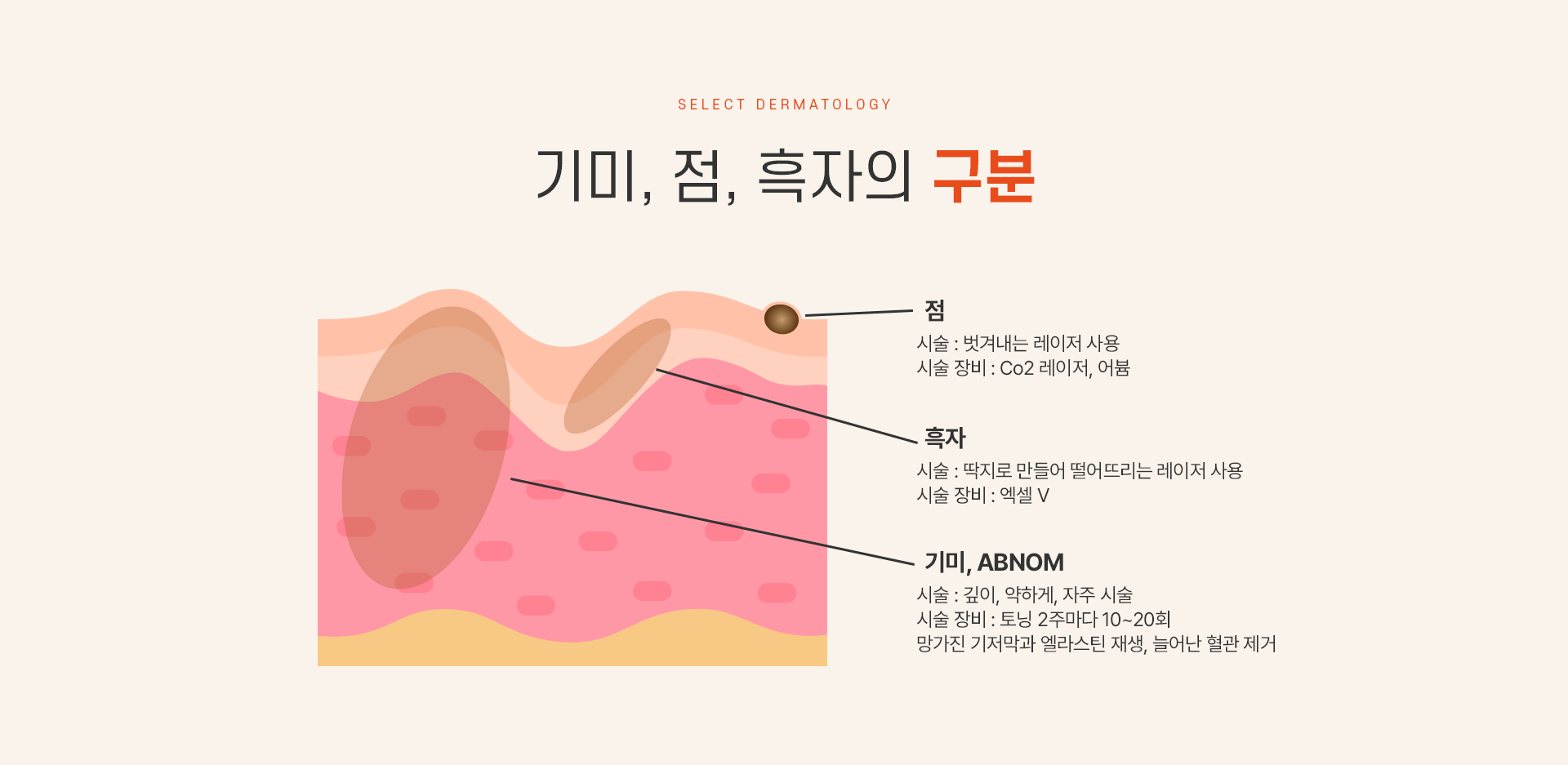 오타모반 치료방법