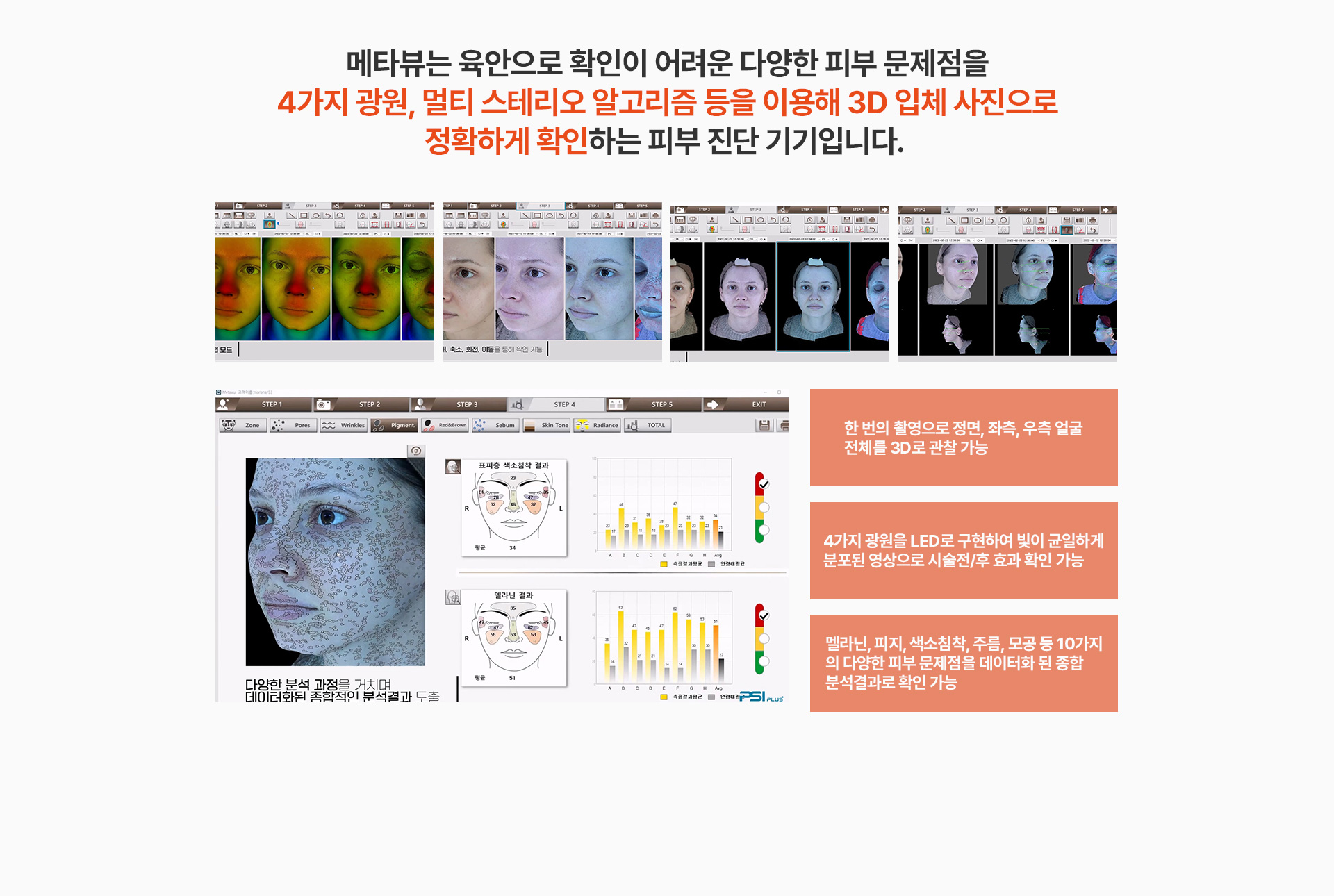 오타모반 치료방법