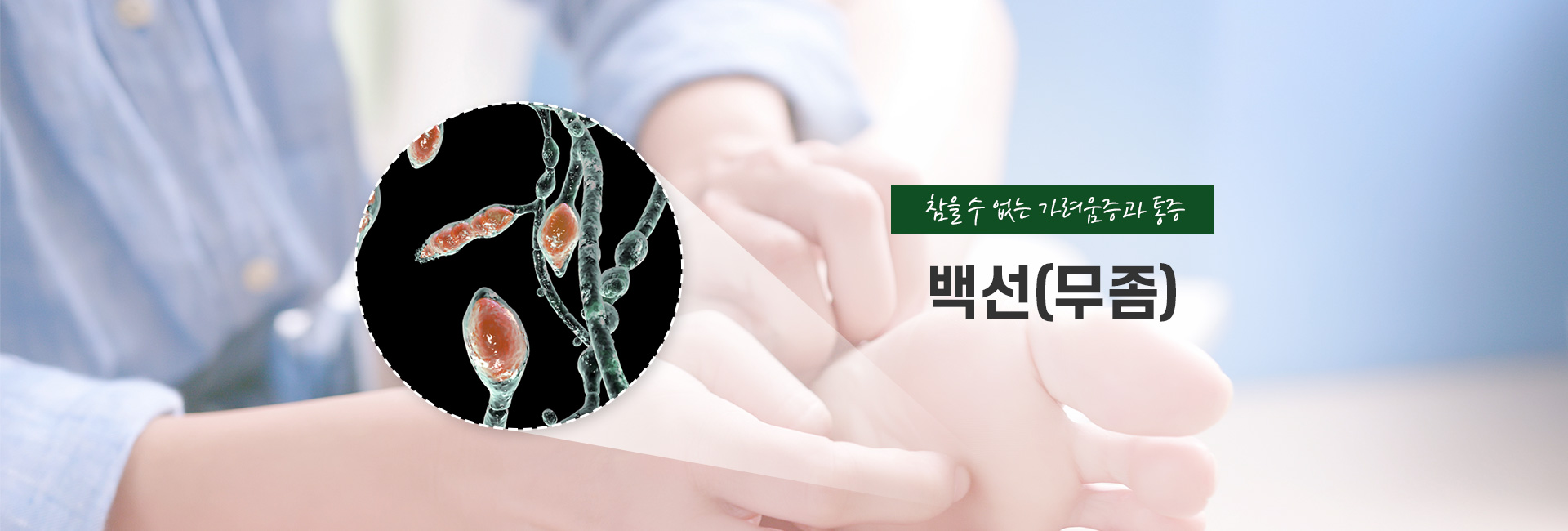 백선 키비주얼