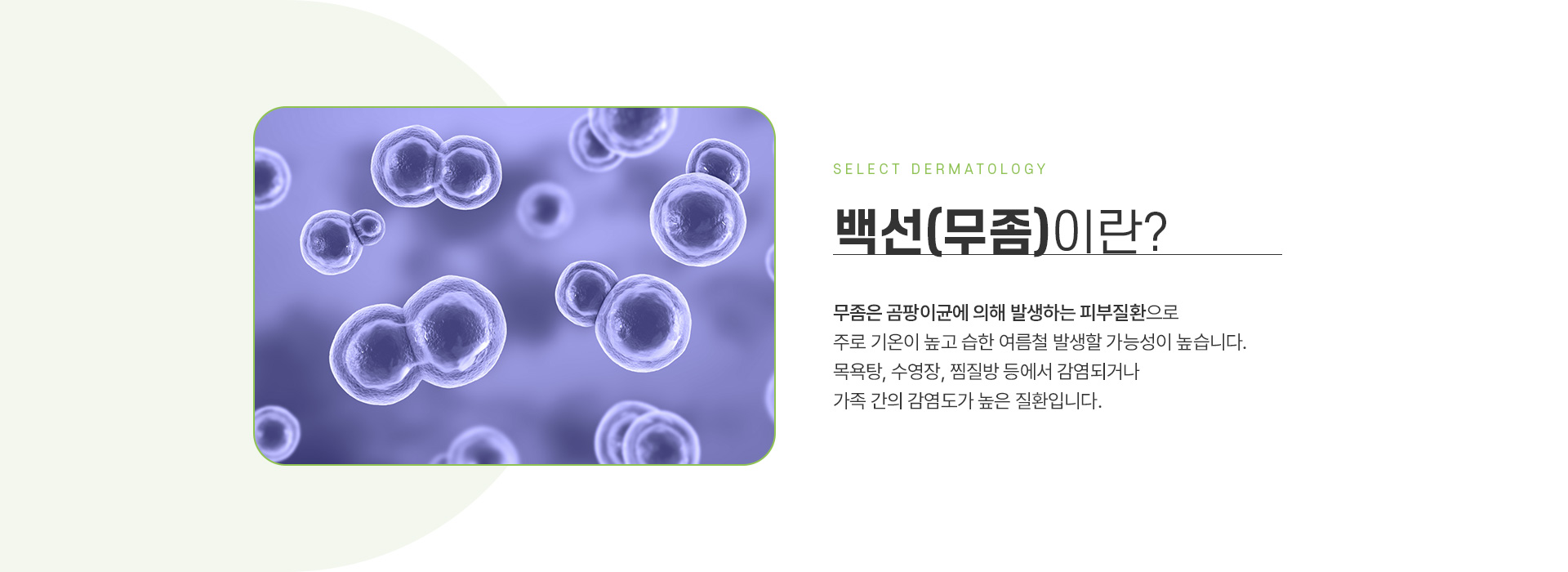 백선 주의