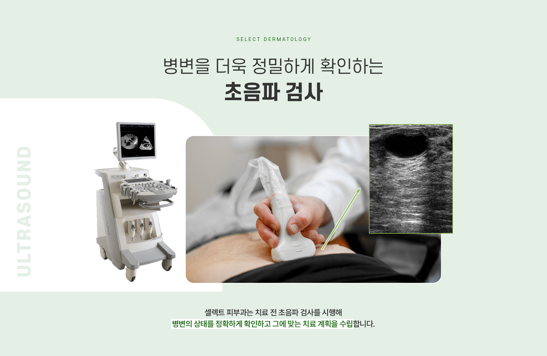 표피낭종 치료방법