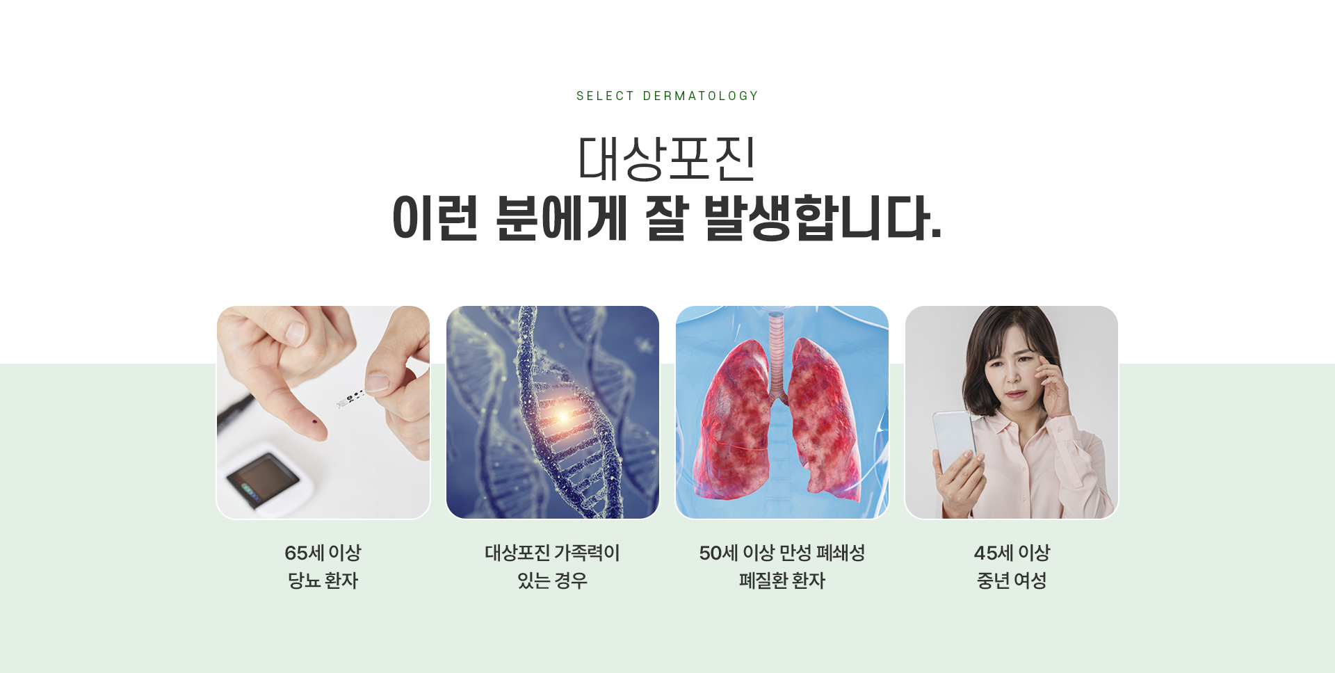 대상포진 주의