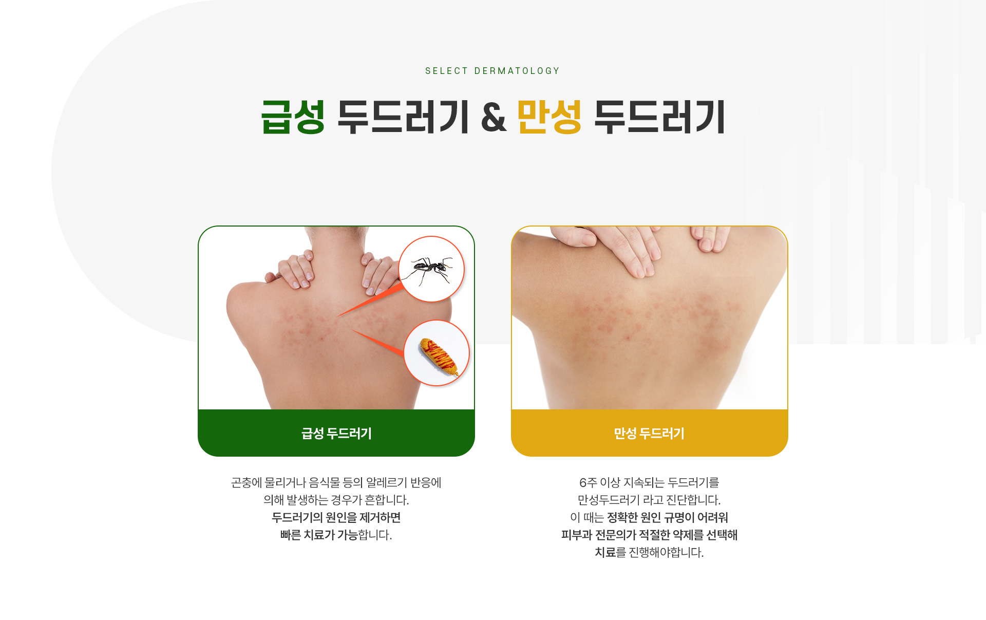 두드러기 주의