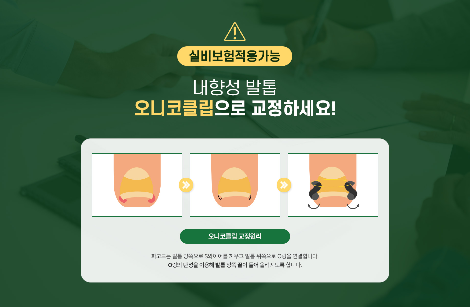 내성발촙 주의