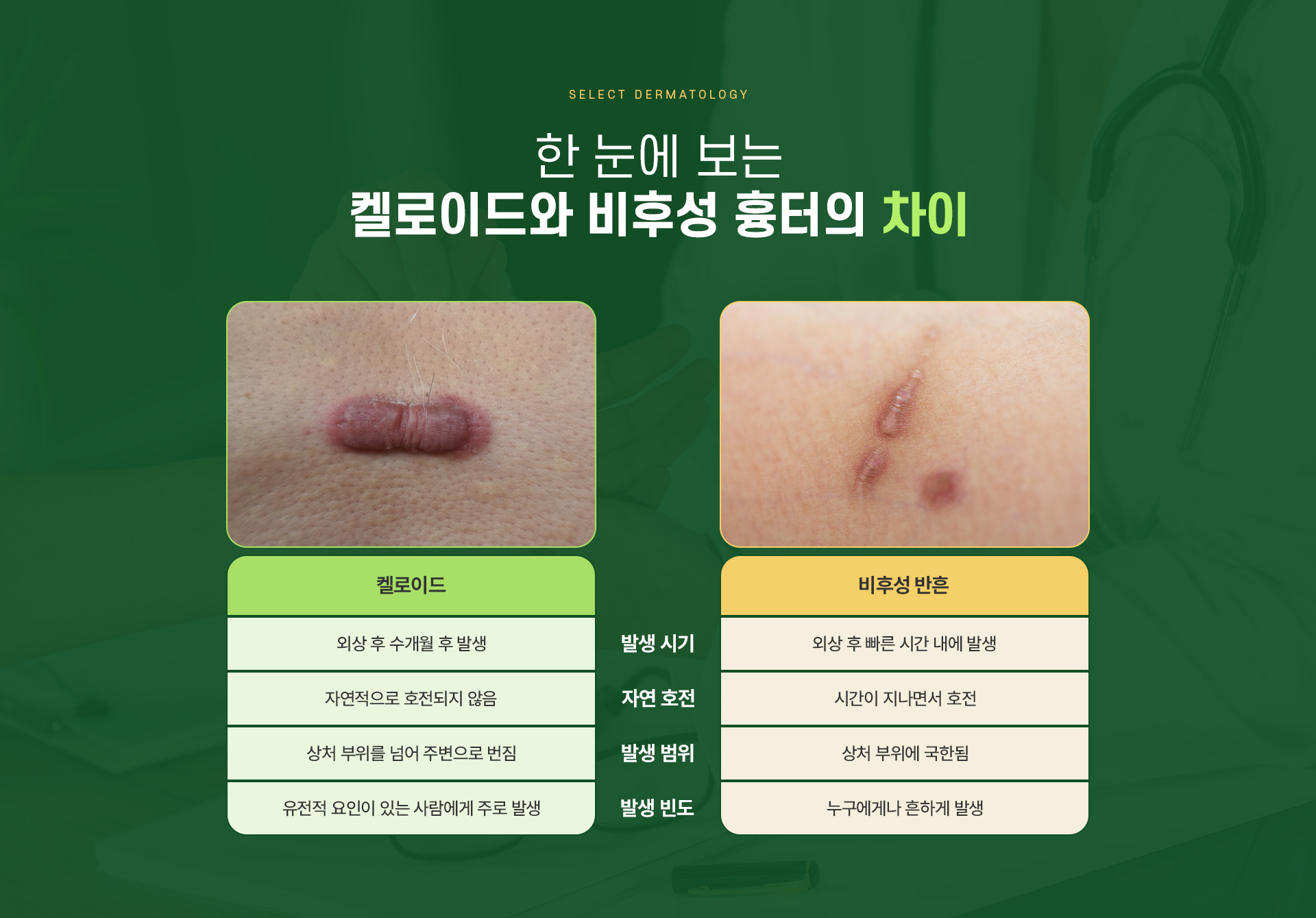 켈로이드 주의