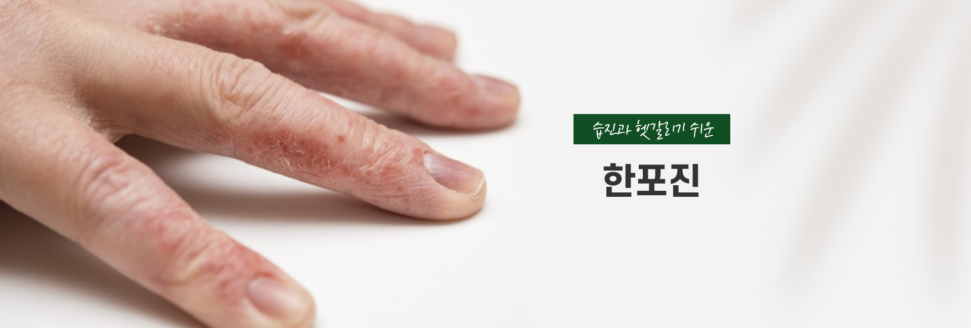 한포진 키비주얼