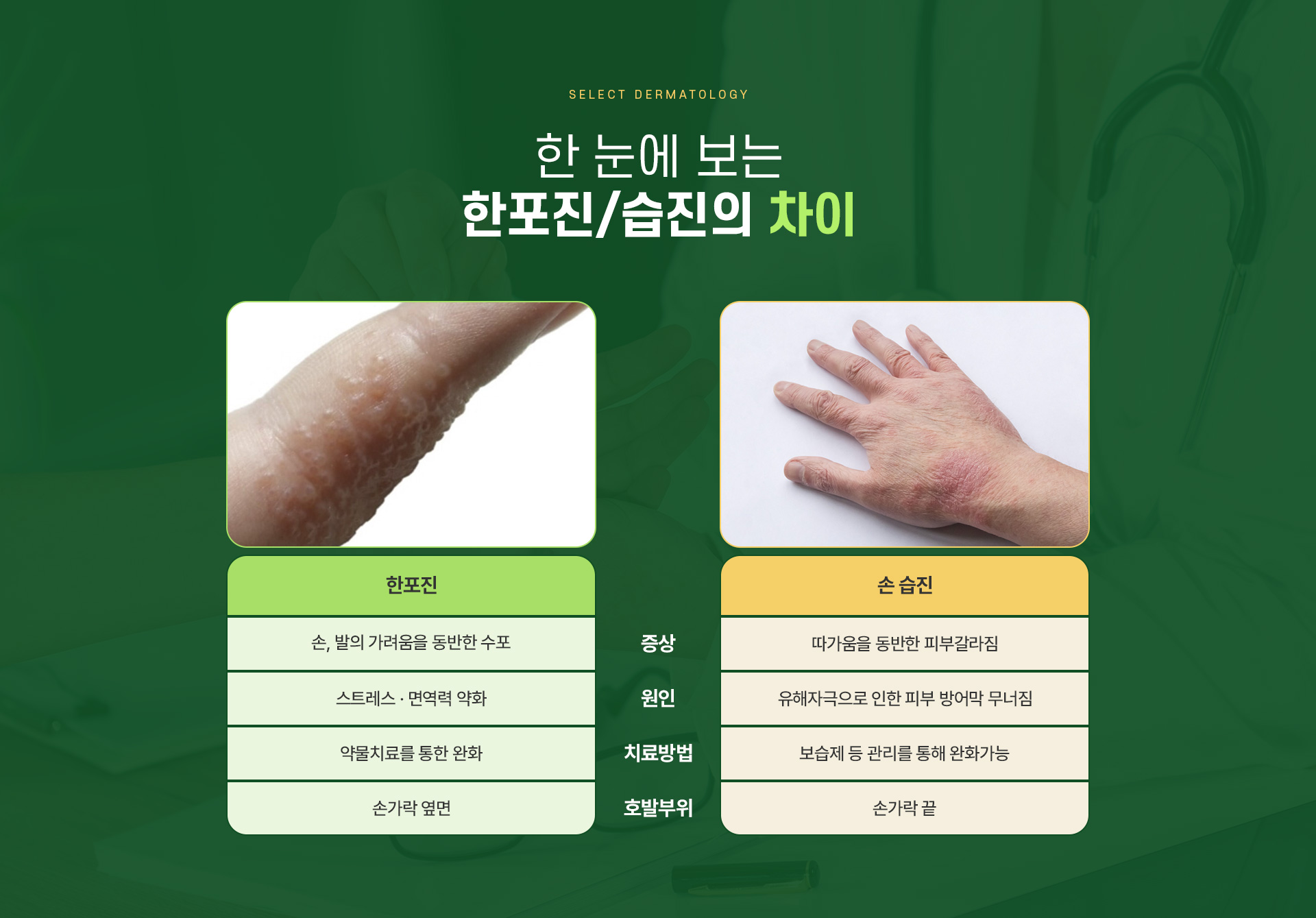 한포진 주의