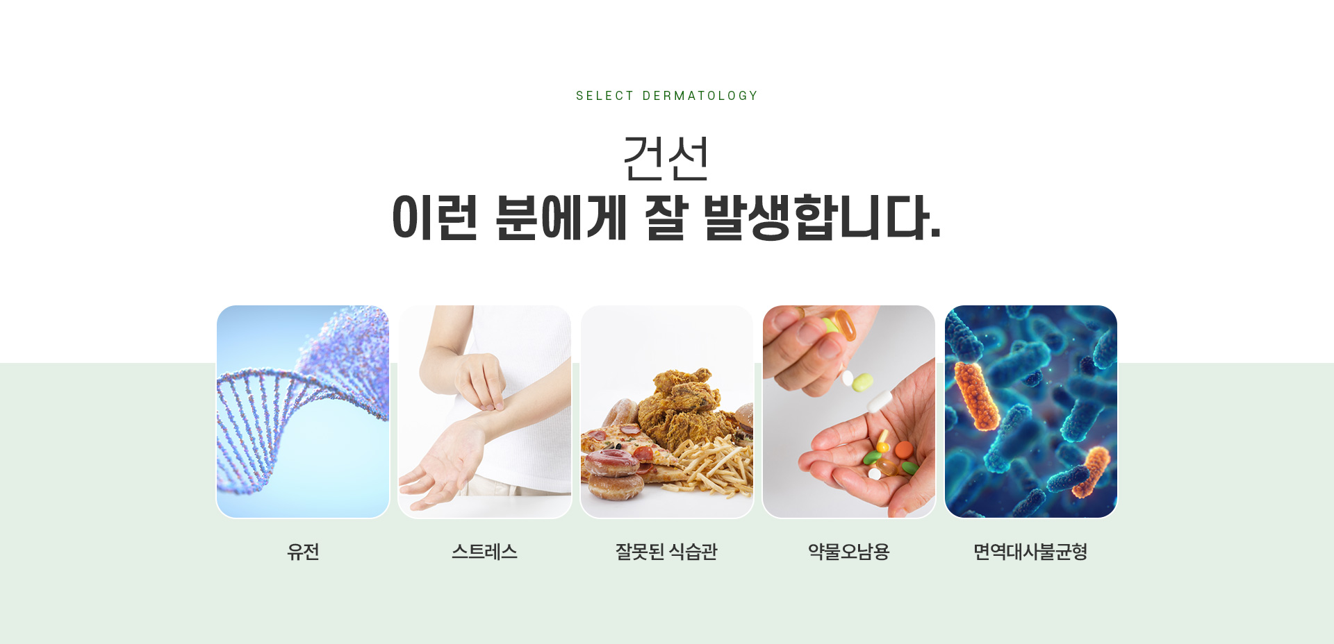 건선 주의