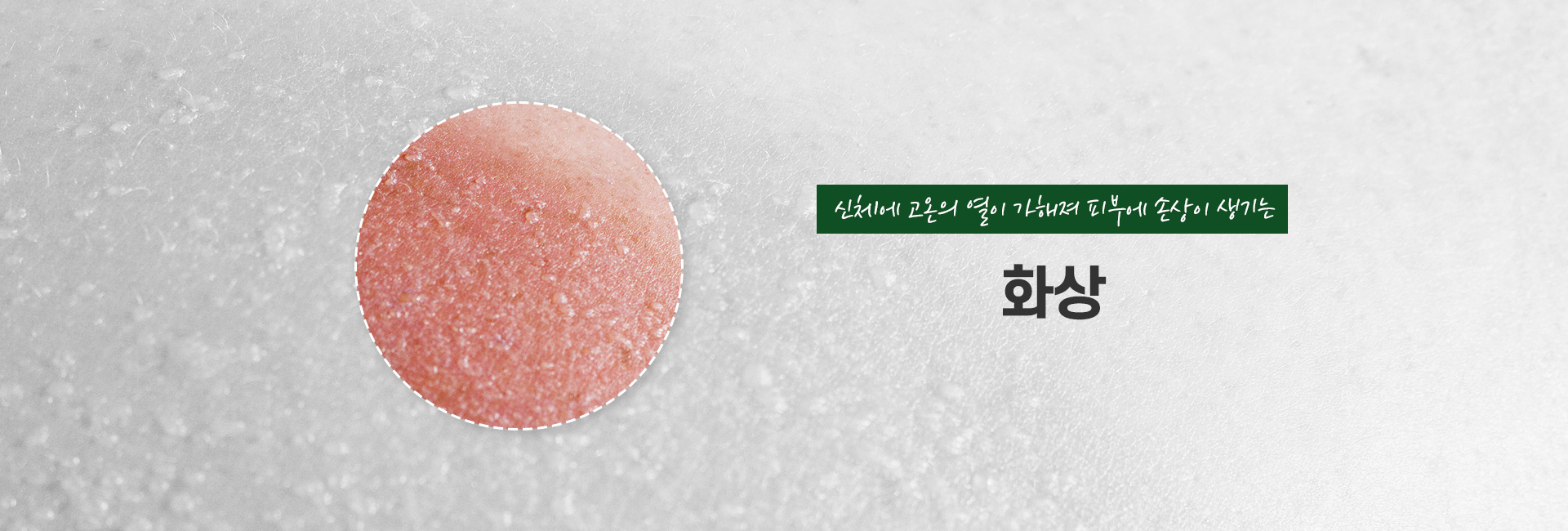 화상 키비주얼