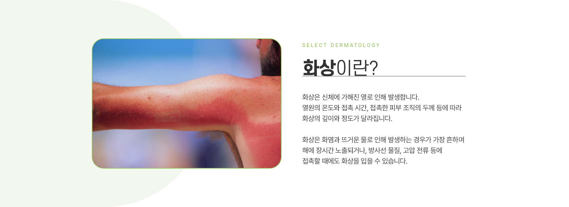 화상 주의